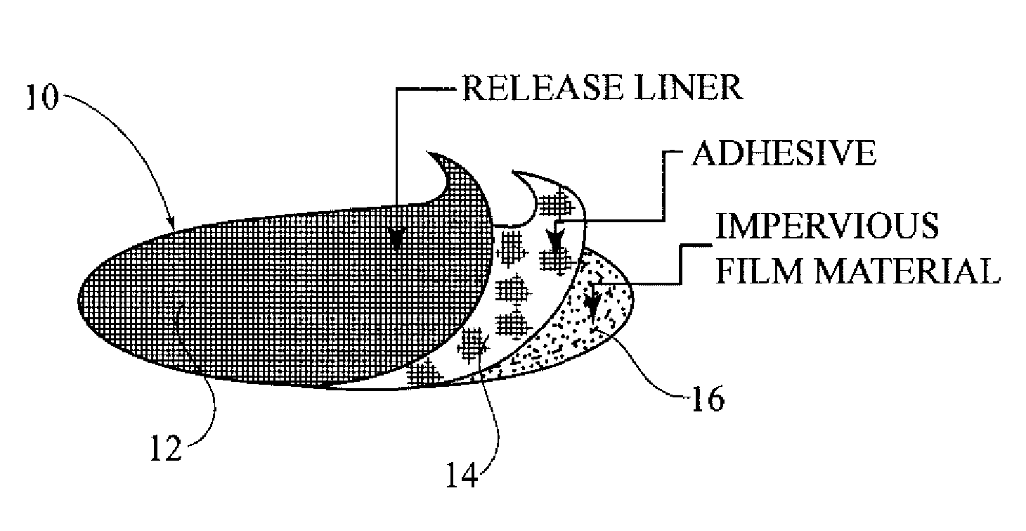 Method and device for female urinary incontinence