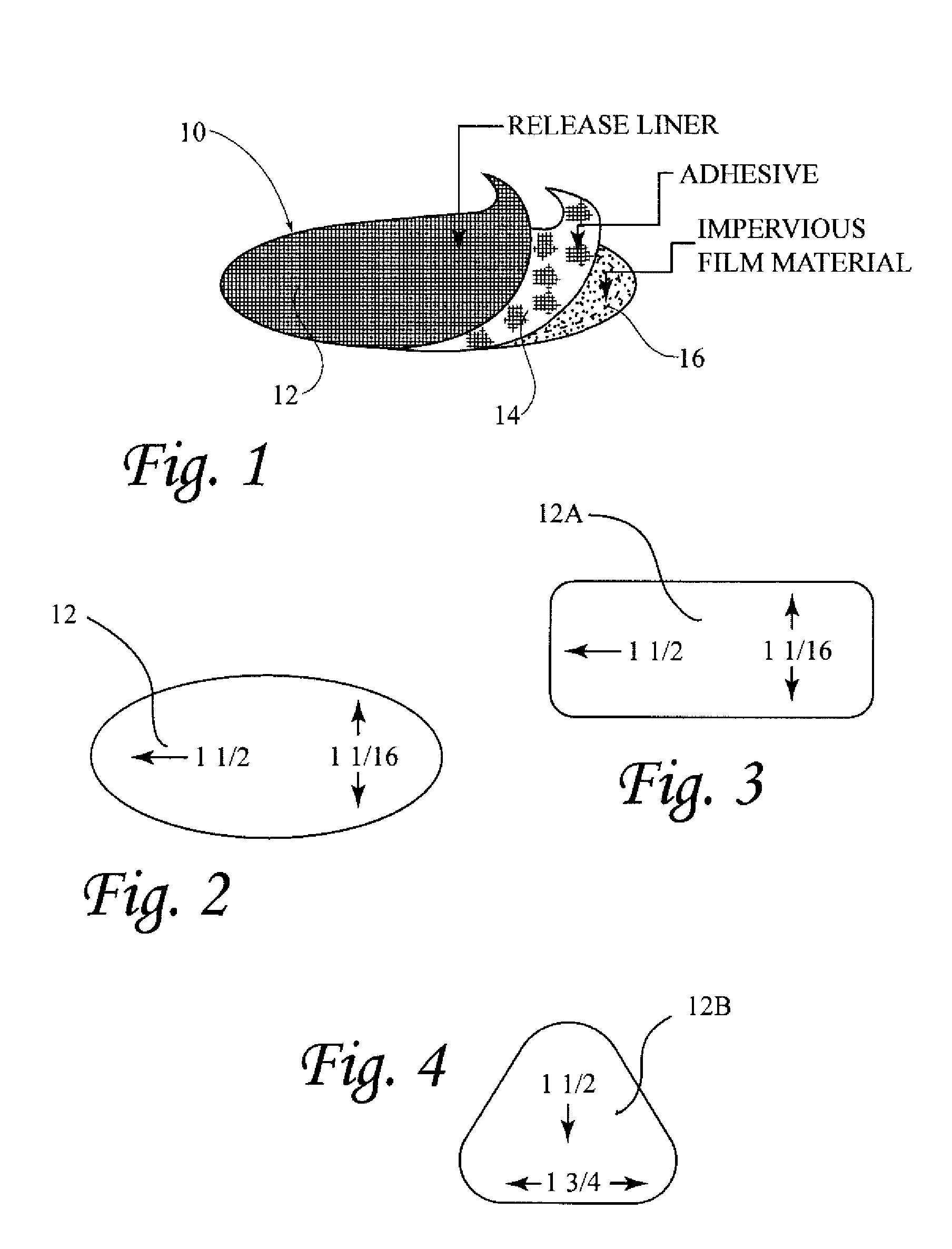 Method and device for female urinary incontinence