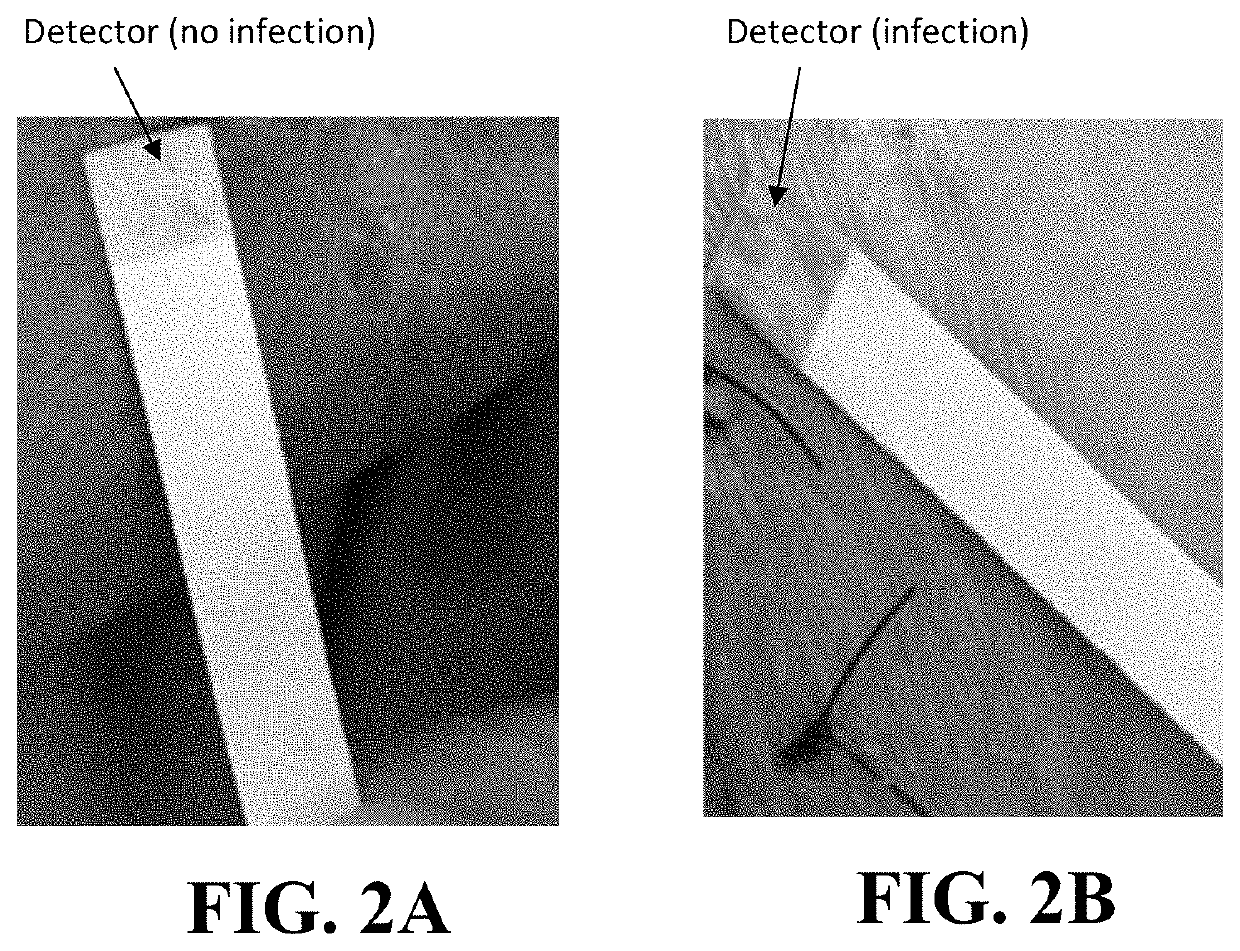 Infection detection device and method using same