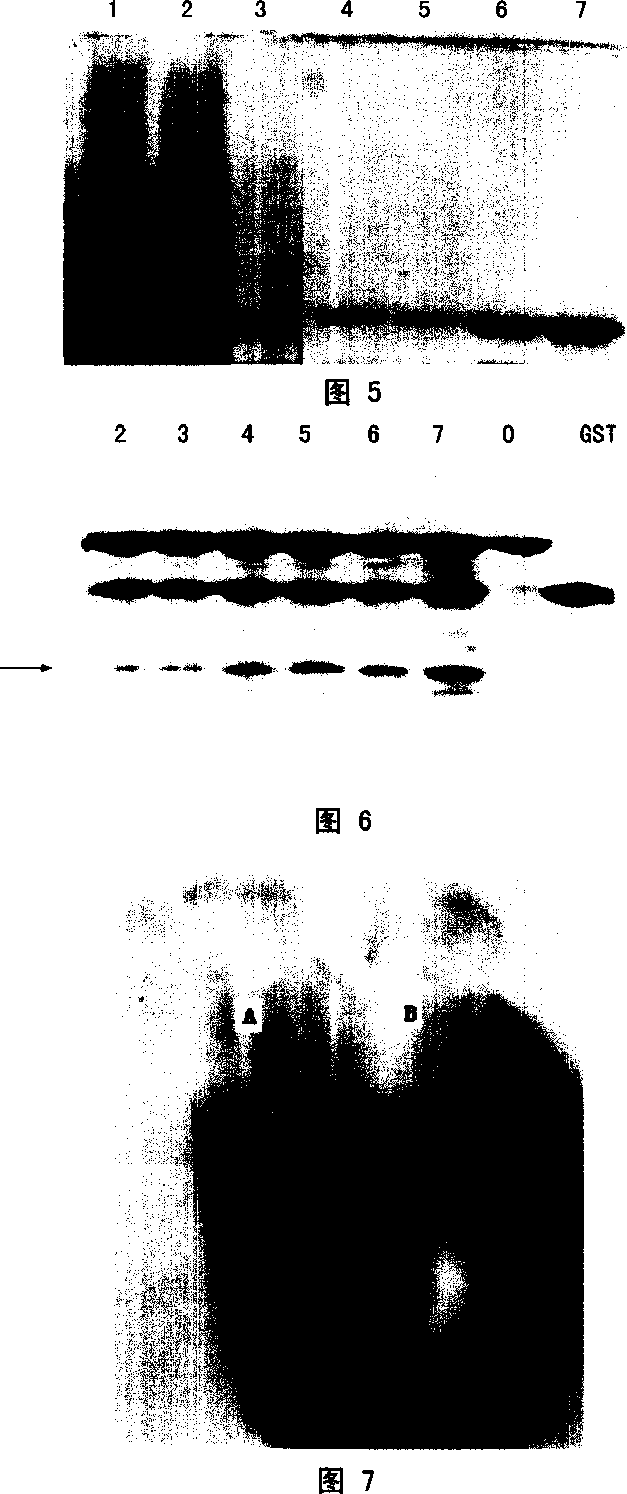 Amphioxus galactose lectin AmphiGAL13-gene and its use