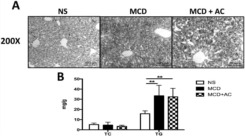 Application of antrodia cinnamomea and monomer lanostane 32 in preventing and treating non-alcoholic fatty liver