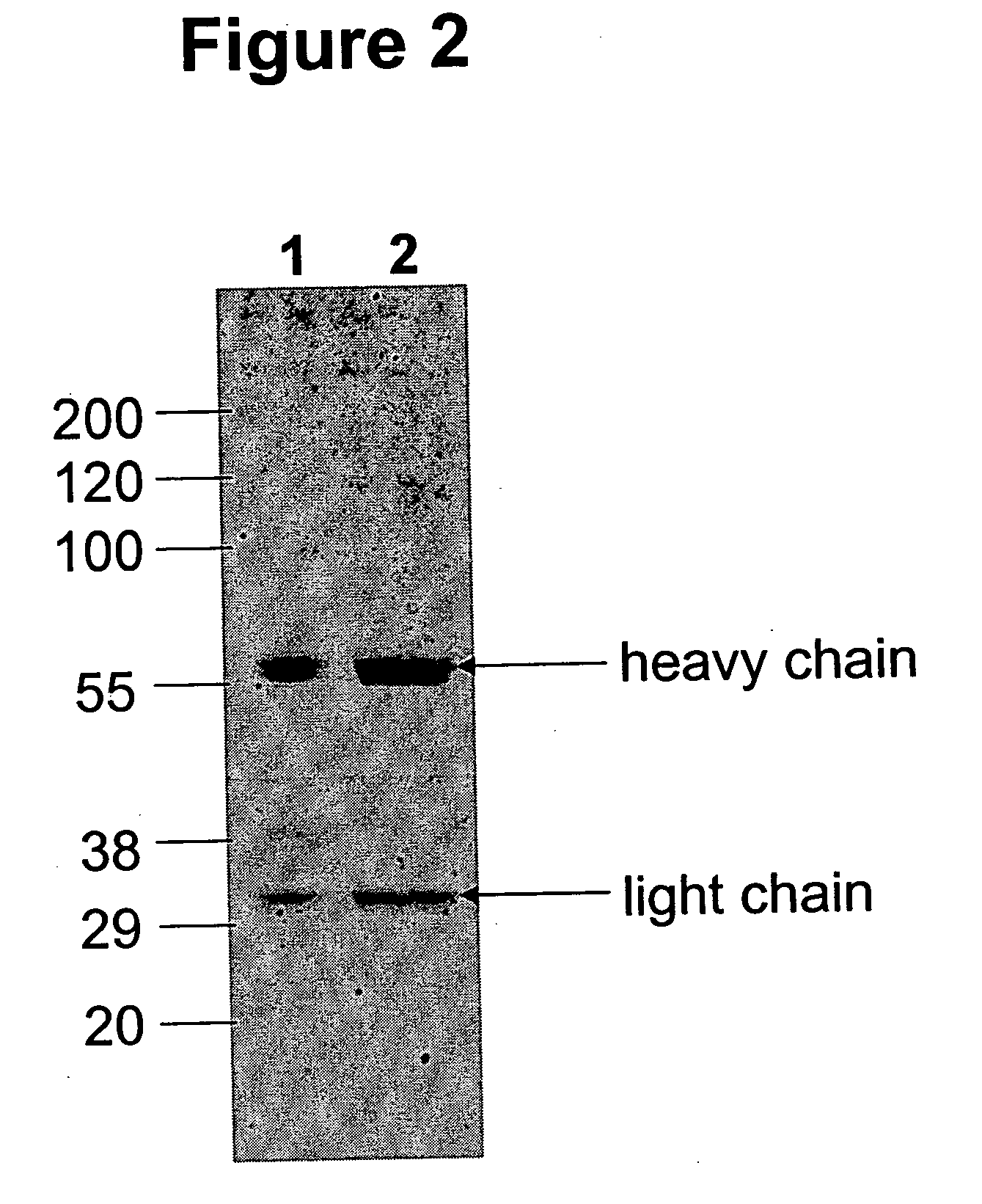 Immunoglobulins comprising predominantly a GlcNAcMAN5GLCNAC2 glycoform