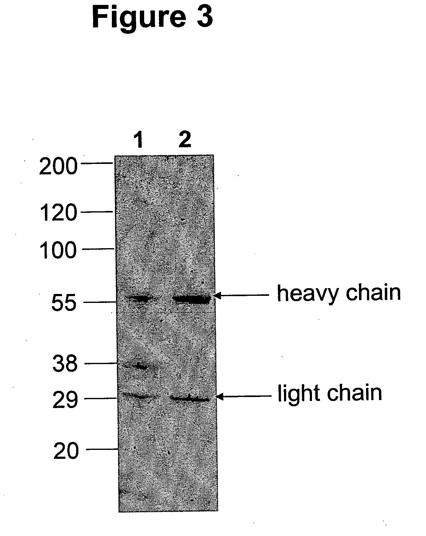 Immunoglobulins comprising predominantly a GlcNAcMAN5GLCNAC2 glycoform