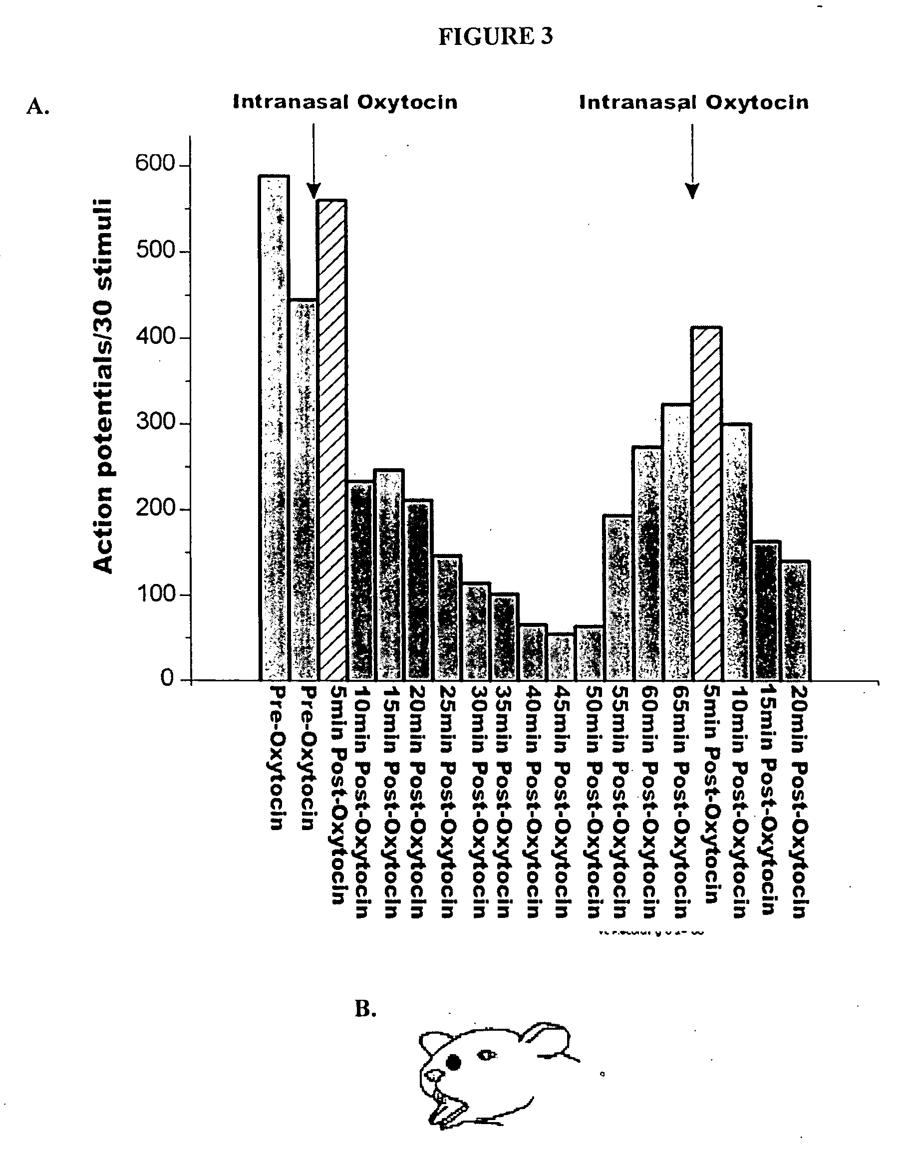 Therapy procedure for drug delivery for trigeminal pain