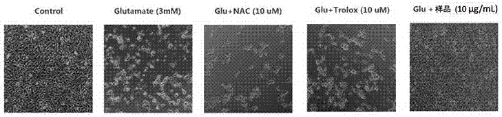 Applications of gendarussa vulgaris Nees extract as neuroprotective agent