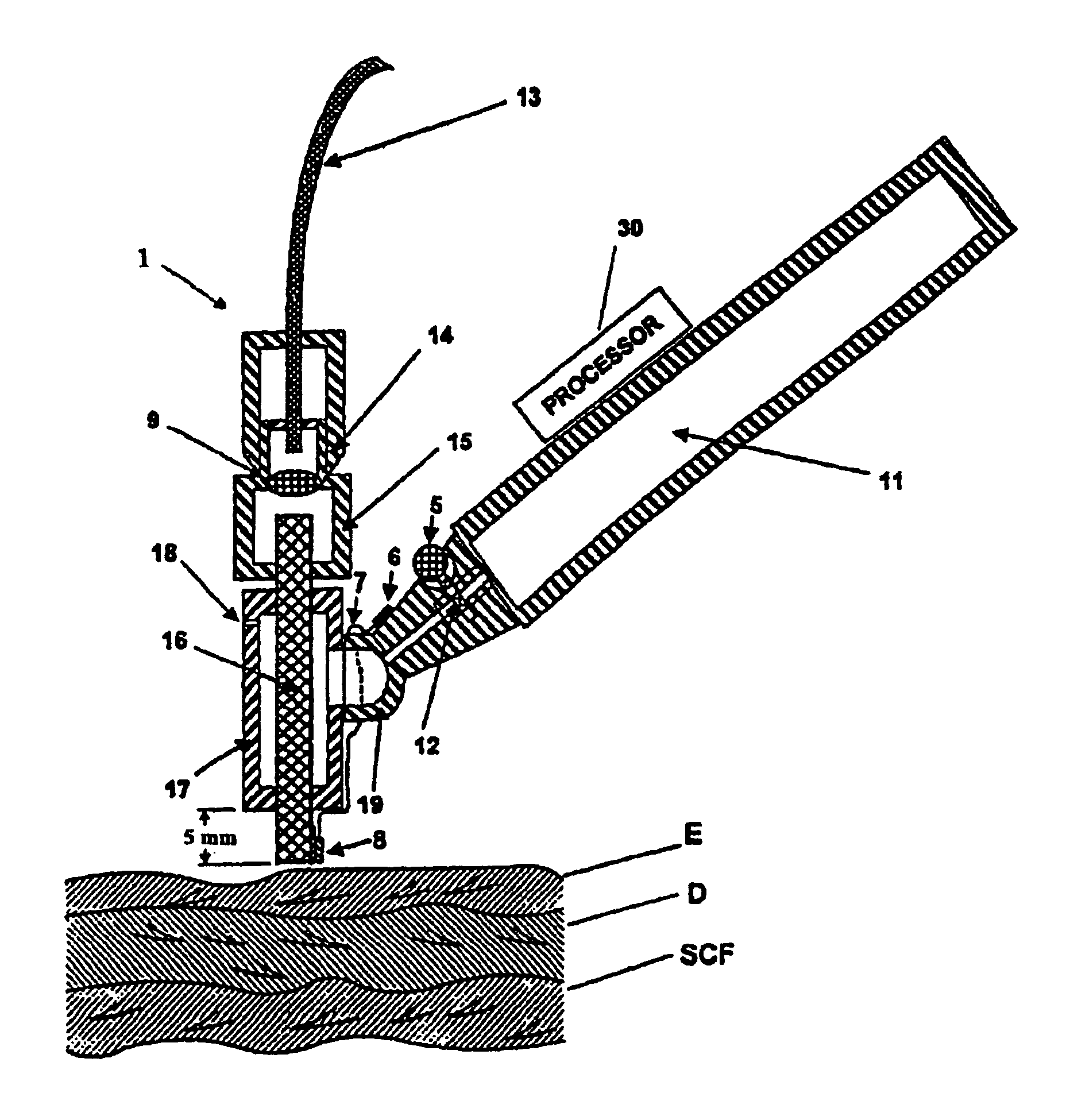 Tissue cooling rod for laser surgery