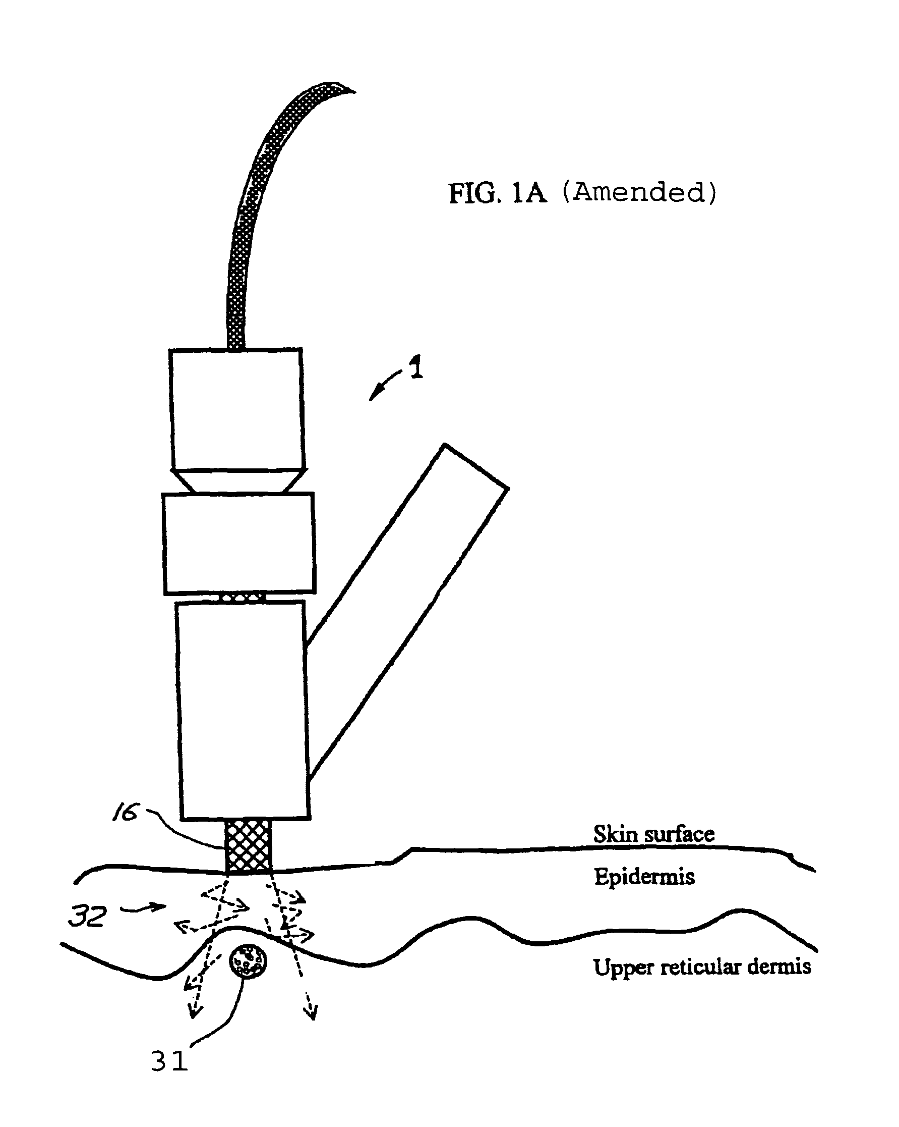 Tissue cooling rod for laser surgery