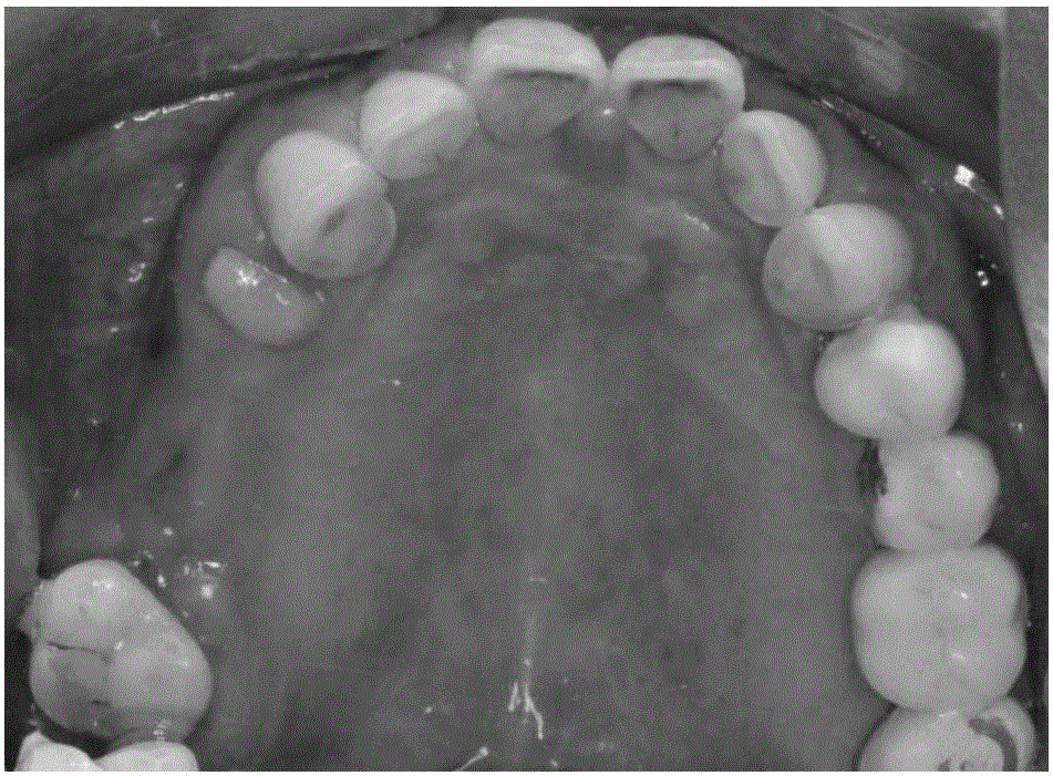 Mobile traffic workstation of CAD (Computer Aided Design)-CAM (Computer Aided Manufacture)-3D printing system and method for automatically processing dental restoration body