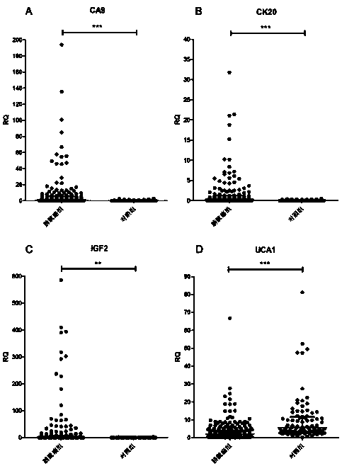 Use of tumor markers CA9 and UCA1 in preparation of kit for non-invasive detection of probability of bladder cancer