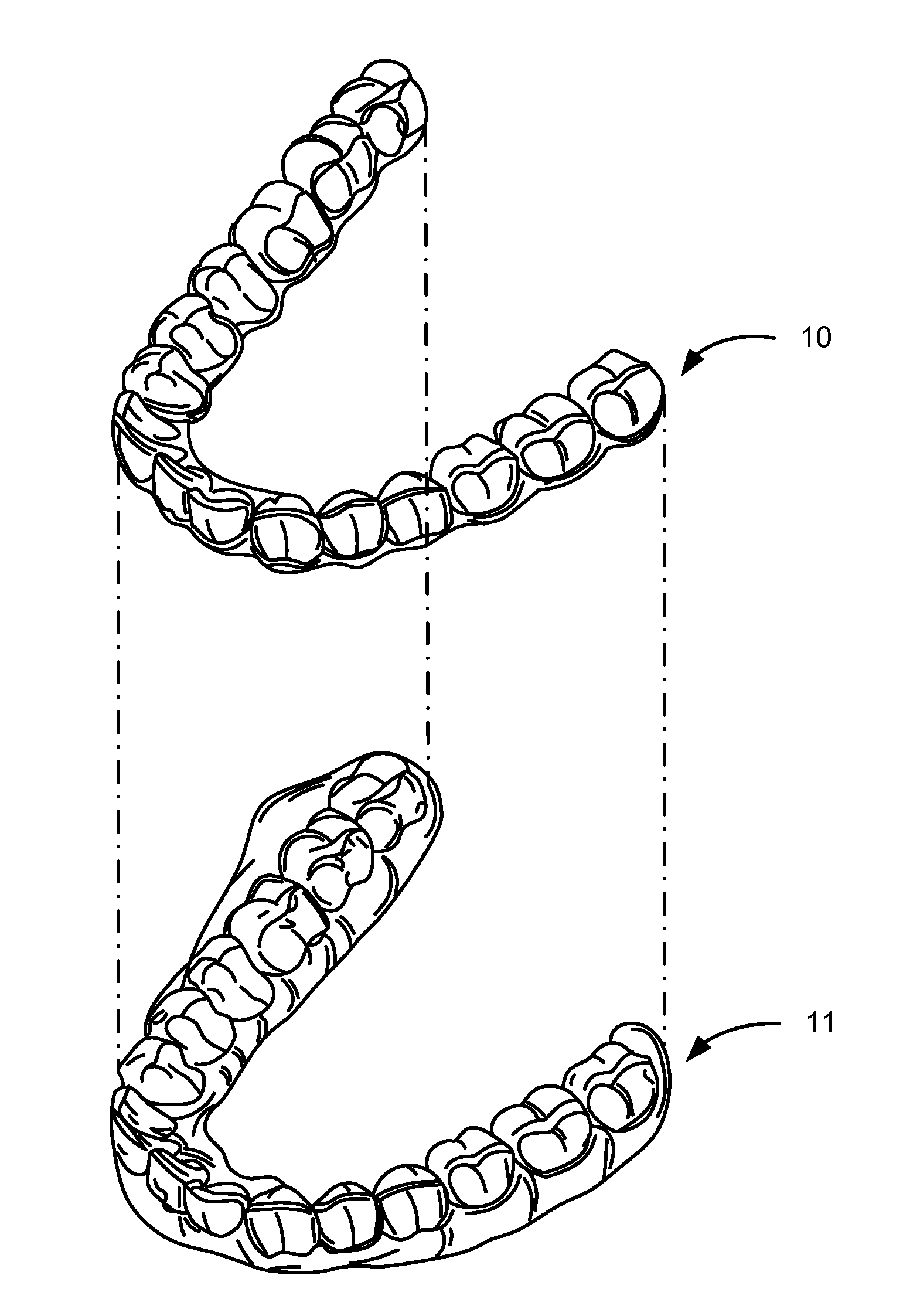 Automatic placement of precision cuts