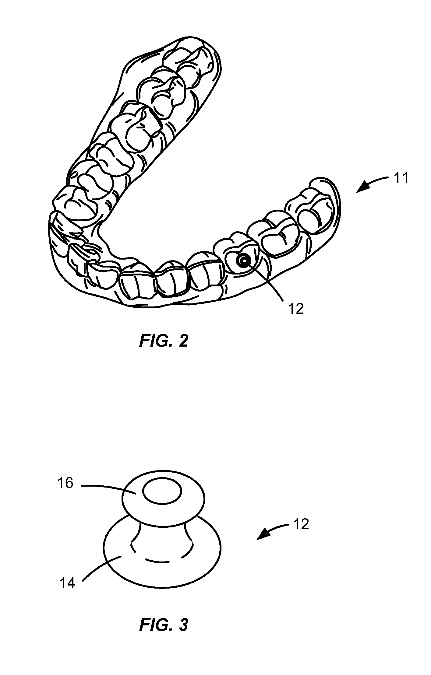 Automatic placement of precision cuts