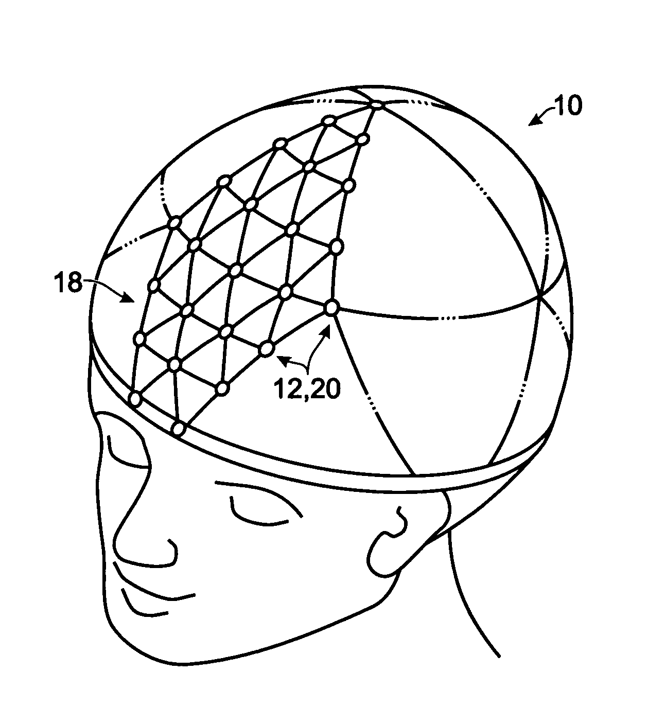 Method for neural current imaging