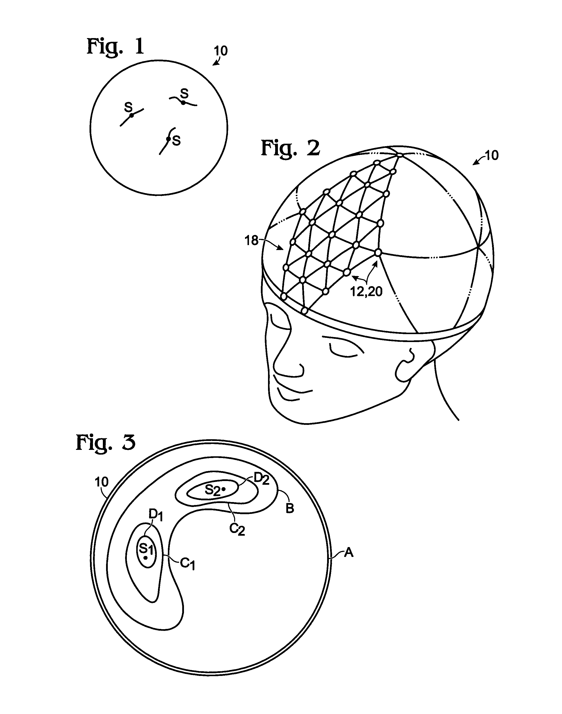 Method for neural current imaging