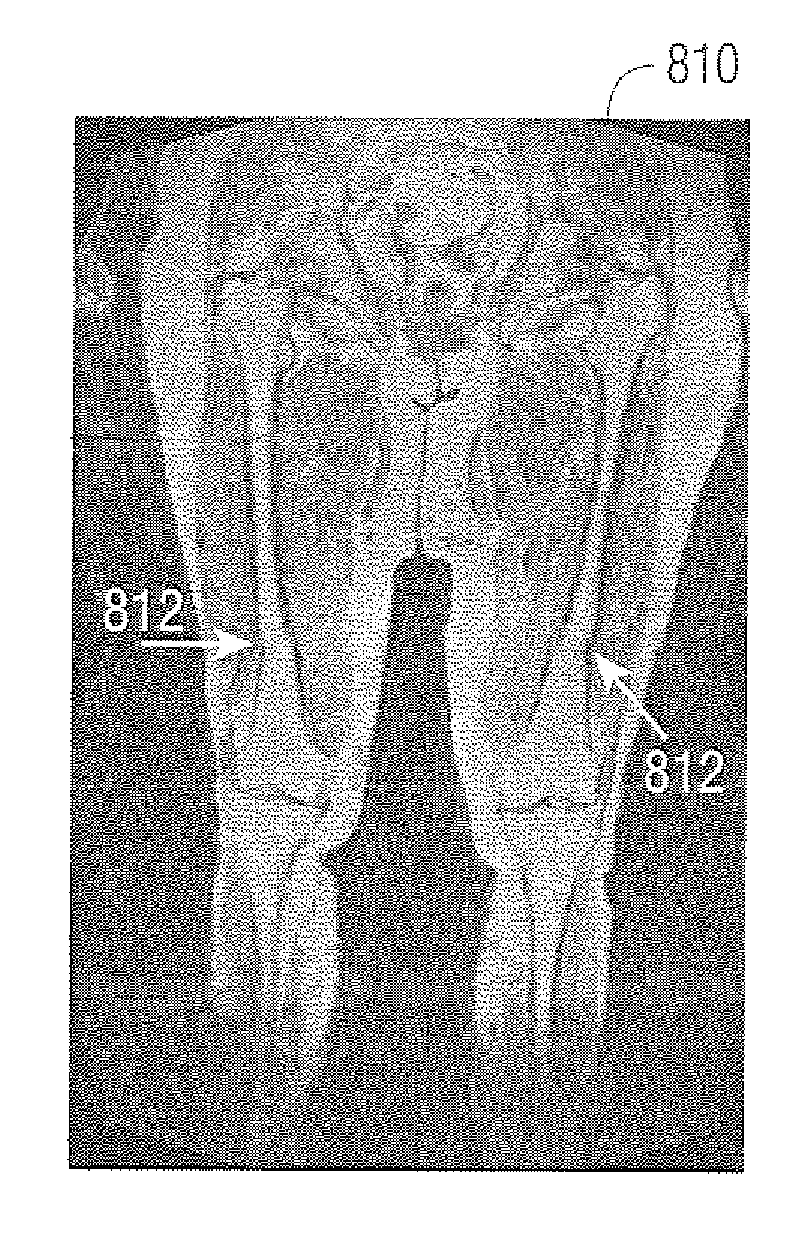 System and method for automated alignment of leg volumes in whole-body magnetic resonance scans