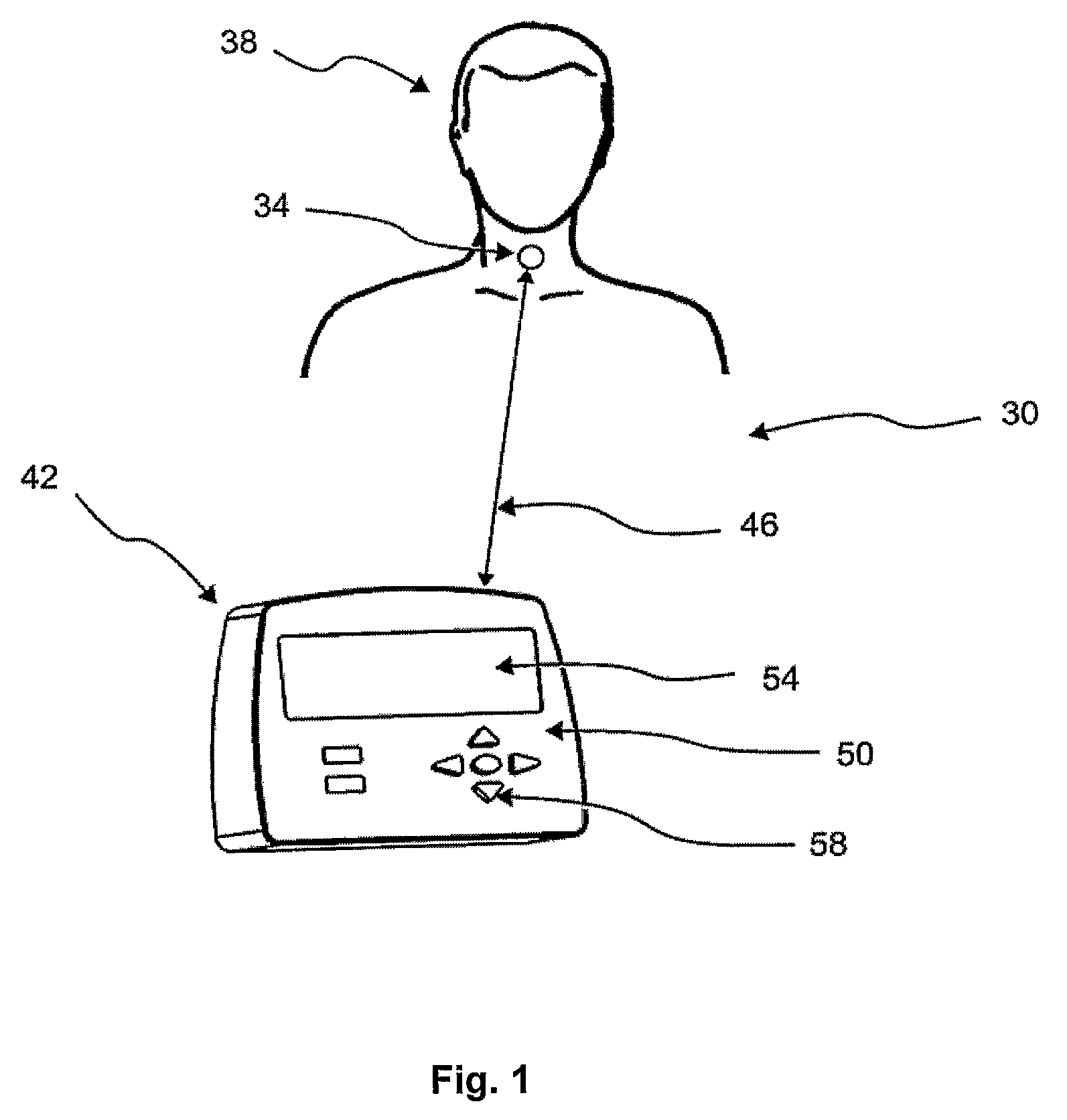 System and method for detecting swallowing activity