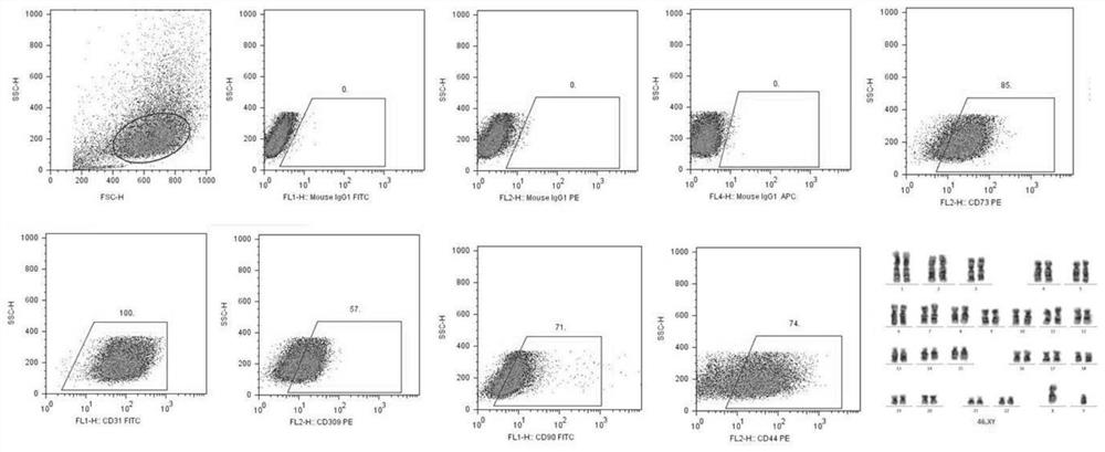 An Efficient Isolation and Culture Method of Adipose Endothelial Progenitor Cells Without Coating