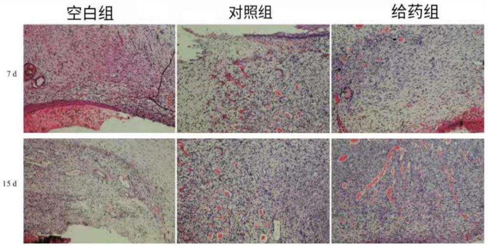 Preparation method of tea polyphenol-pichia pastoris recombinant collagen sponge scaffold gel and application of tea polyphenol-pichia pastoris recombinant collagen sponge scaffold gel in skin inflammation repair