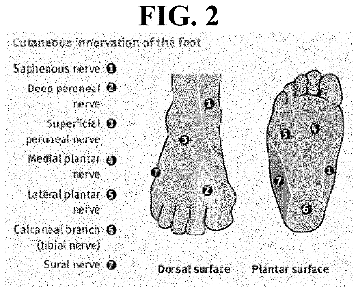 Signal transduction device