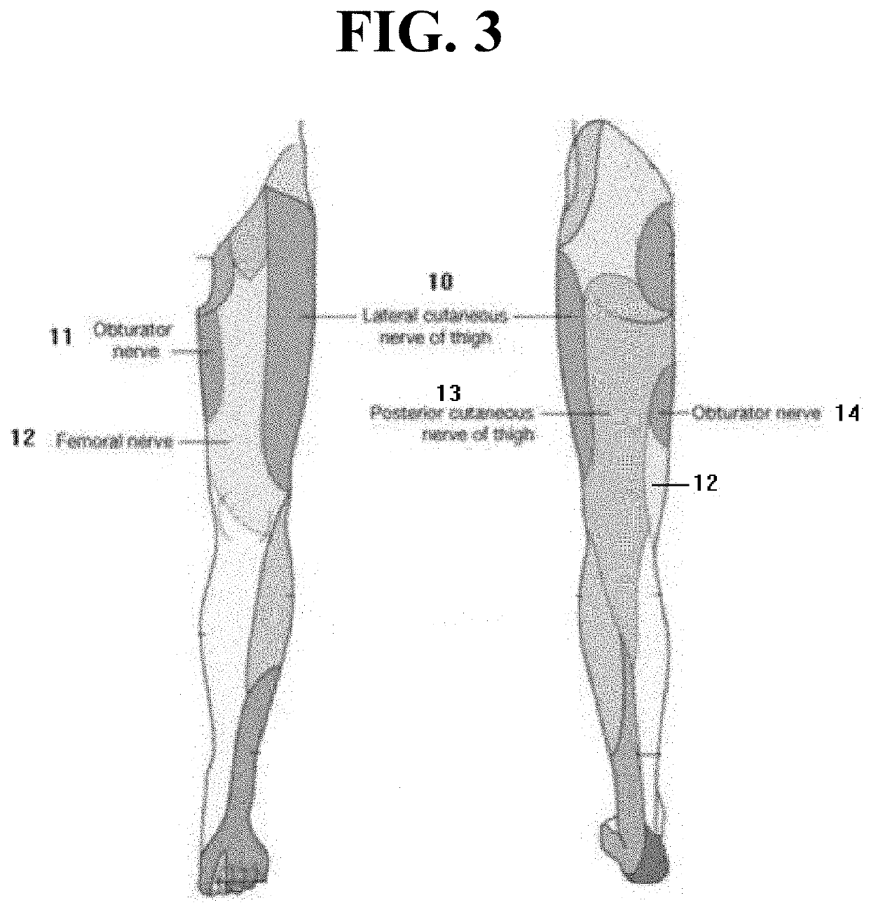 Signal transduction device