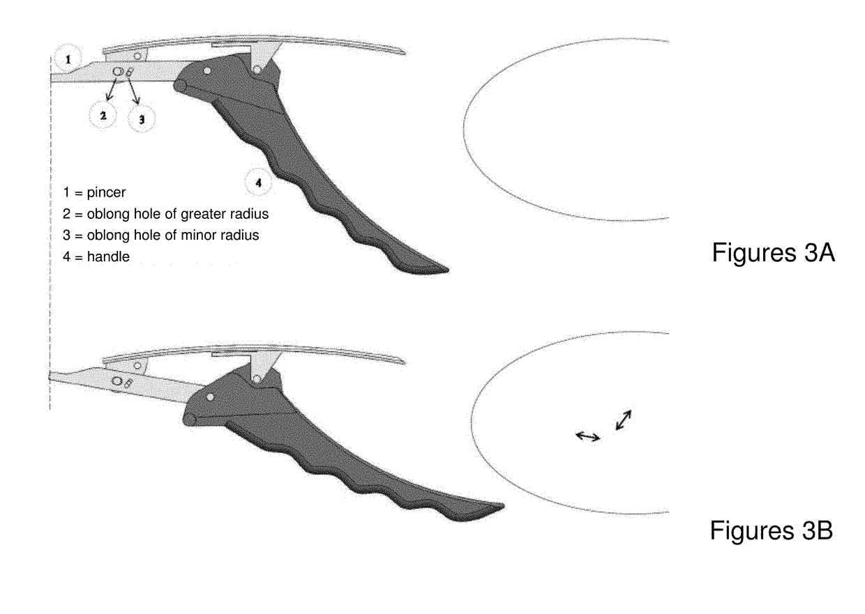 Pincers for the extraction of teeth and residual dental roots