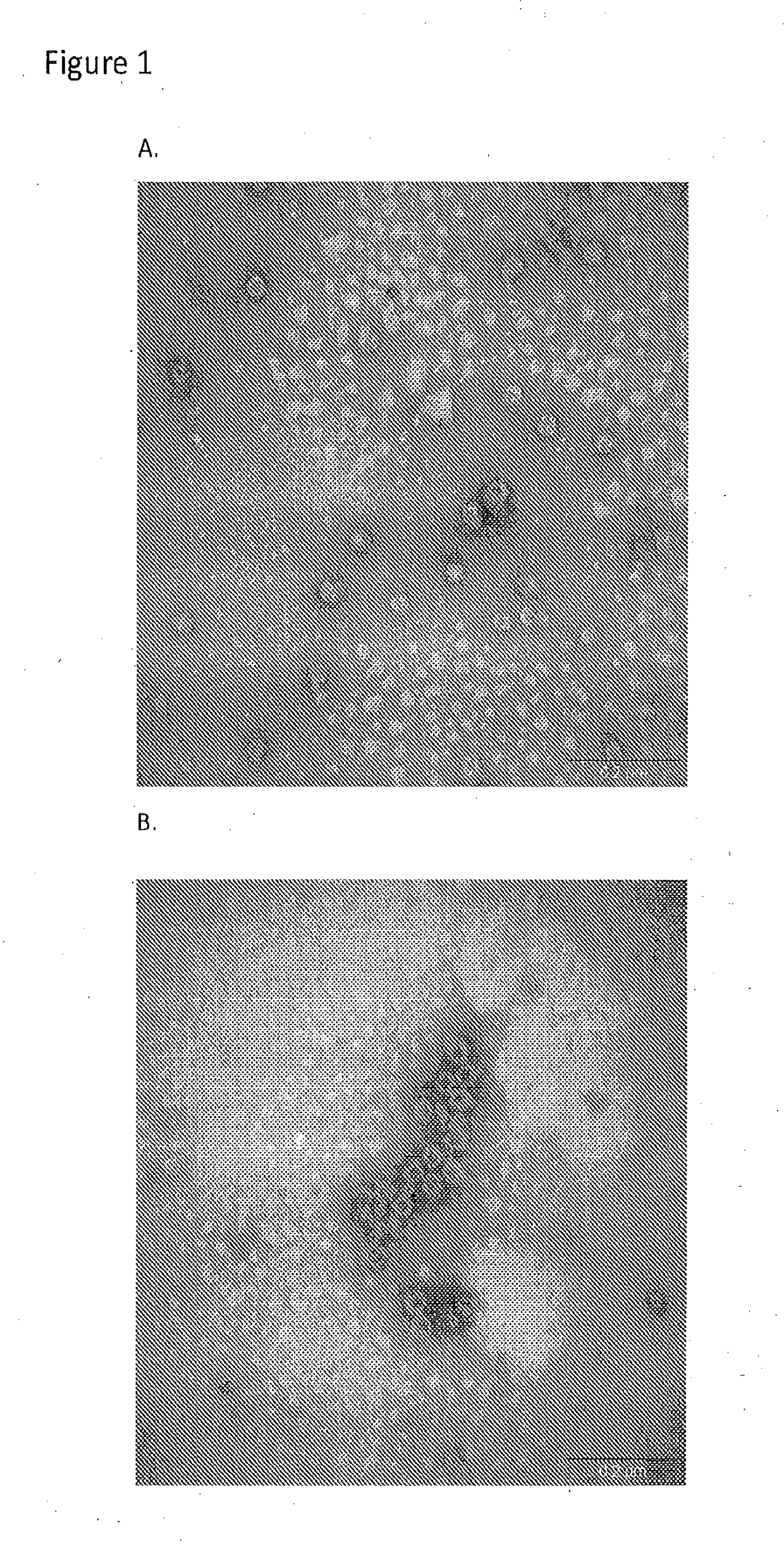 Norovirus vaccine