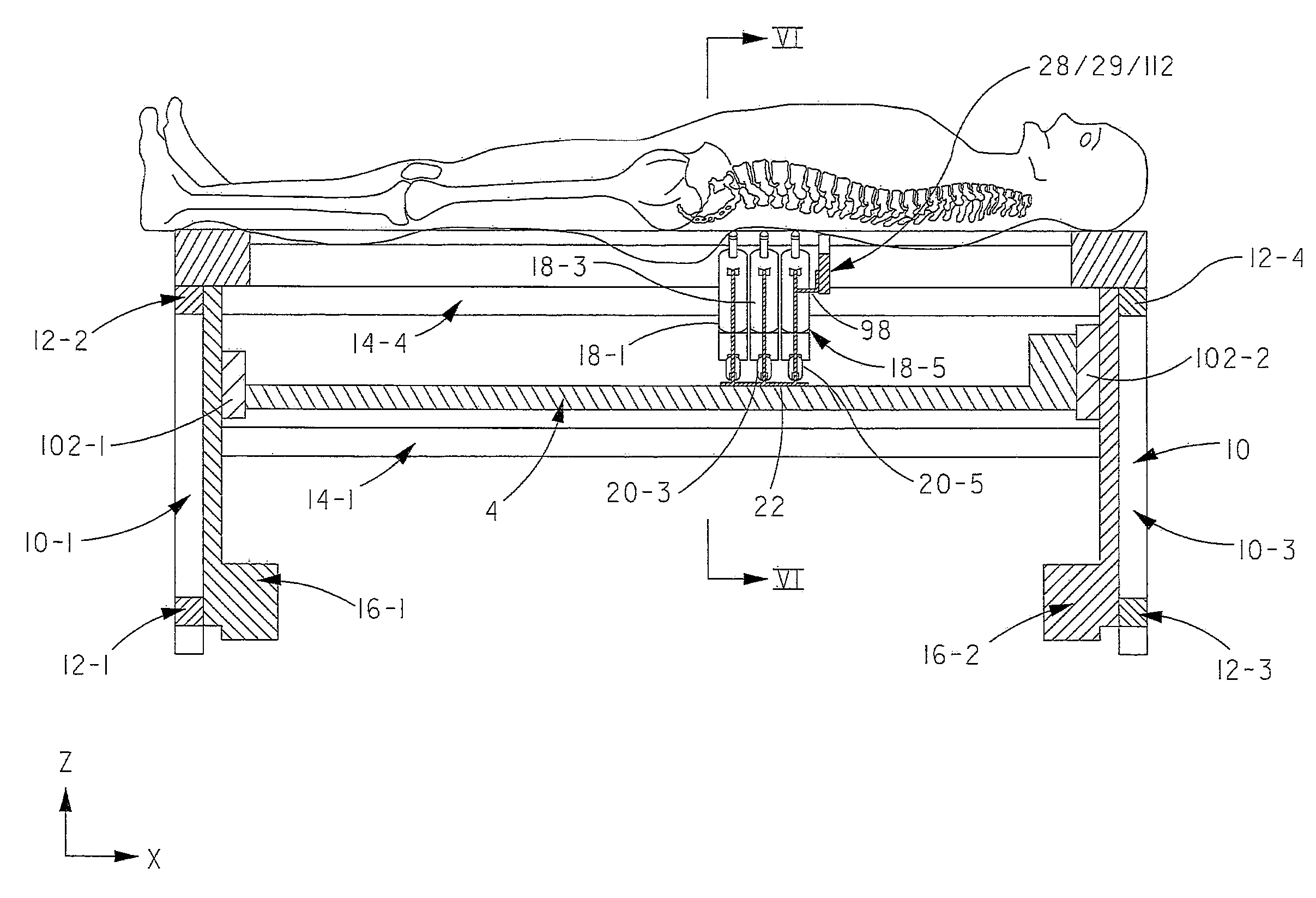 Closed-Loop Automated Chiropractic Adjustment Device