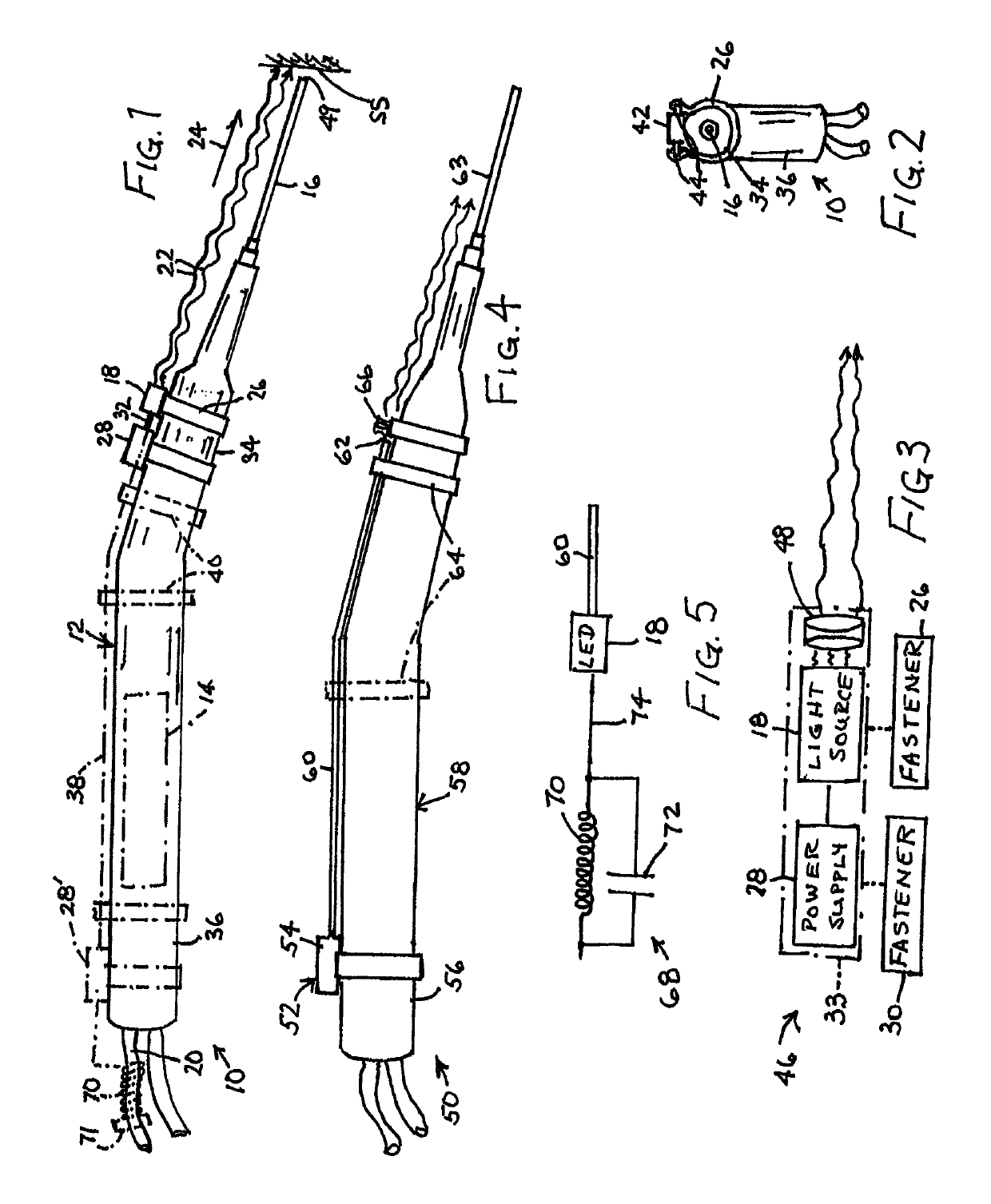 Ultrasonic surgical instrument assembly, related accessory, and associated surgical method