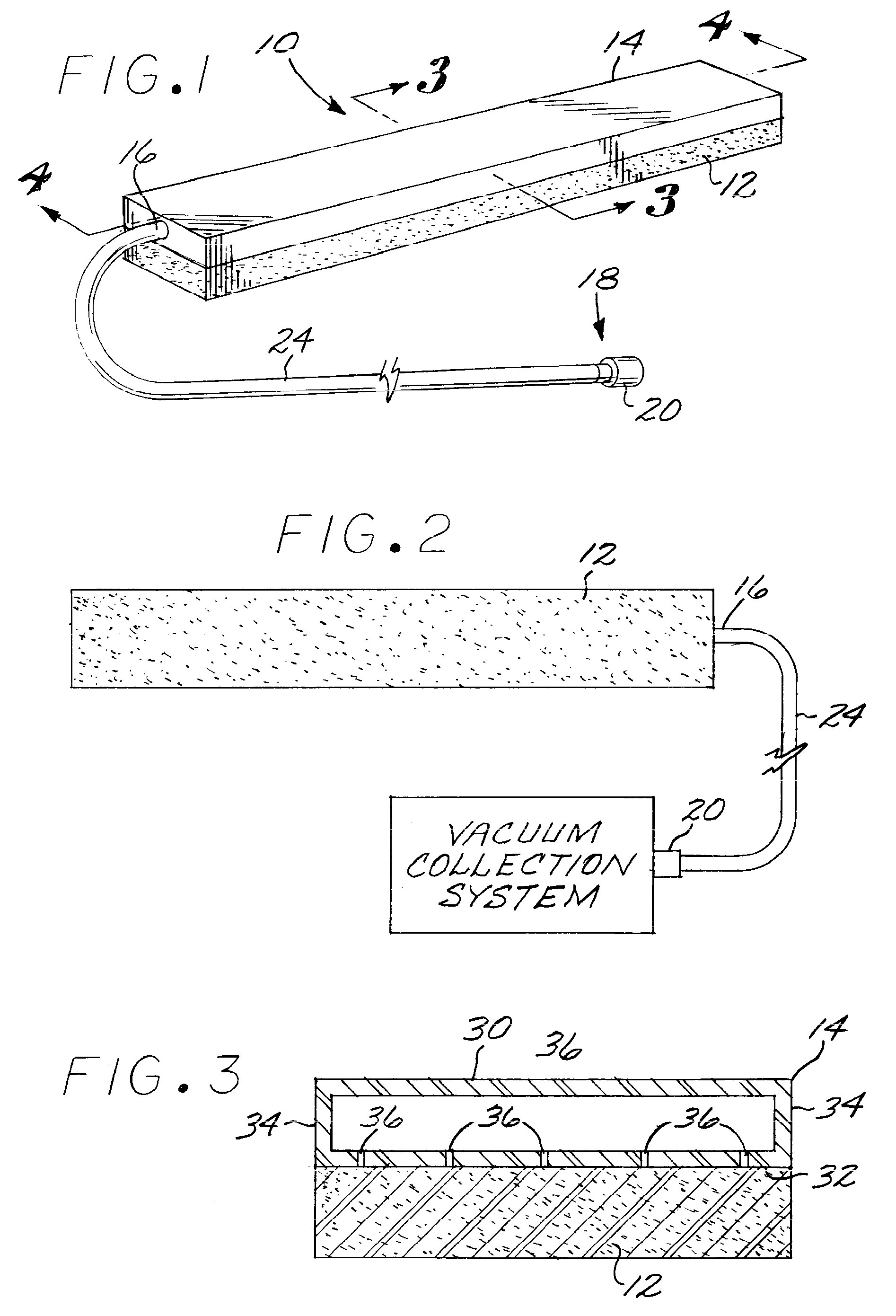 Liquid removal method and apparatus for surgical procedures