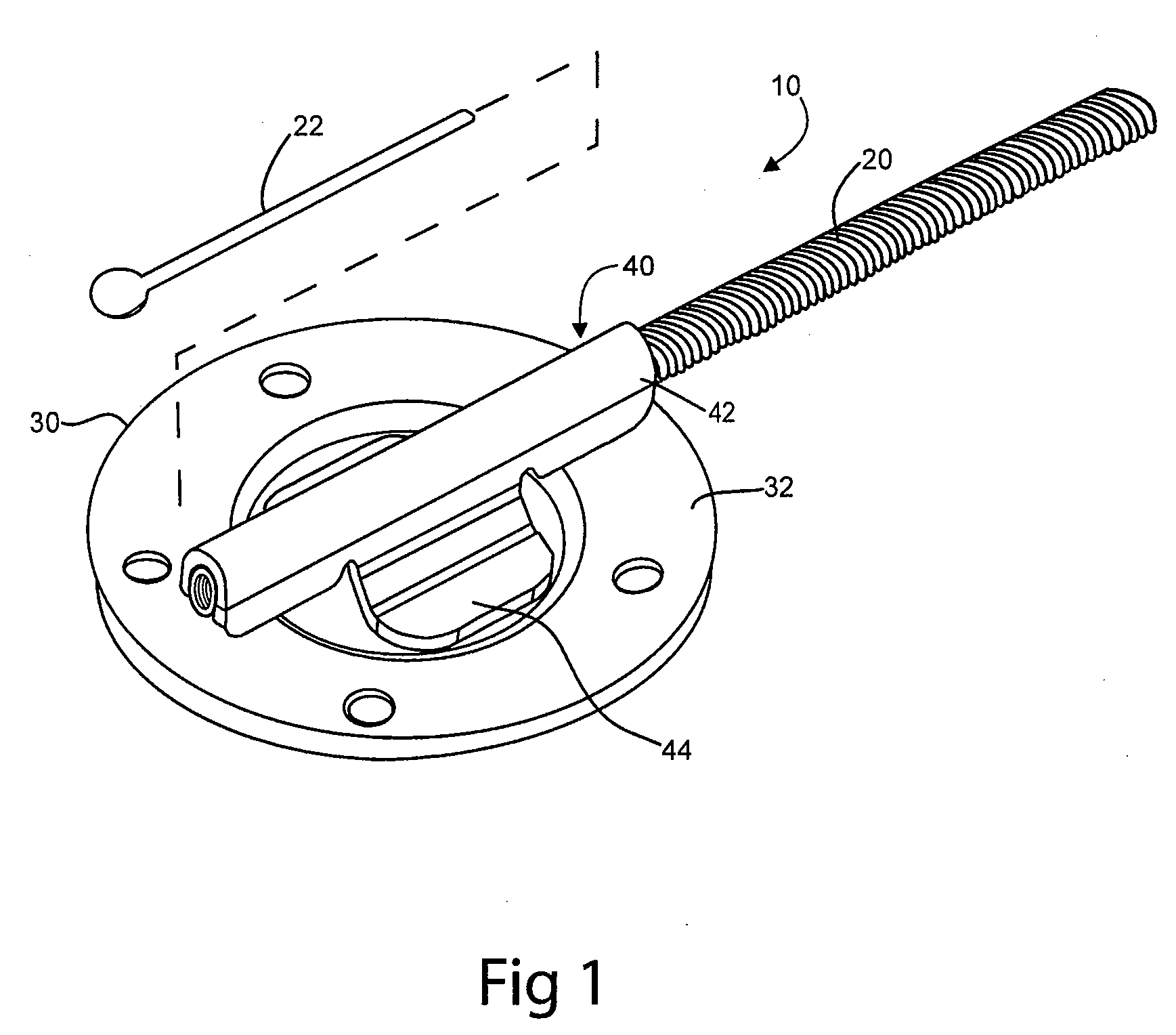 Methods and systems for securing electrode leads