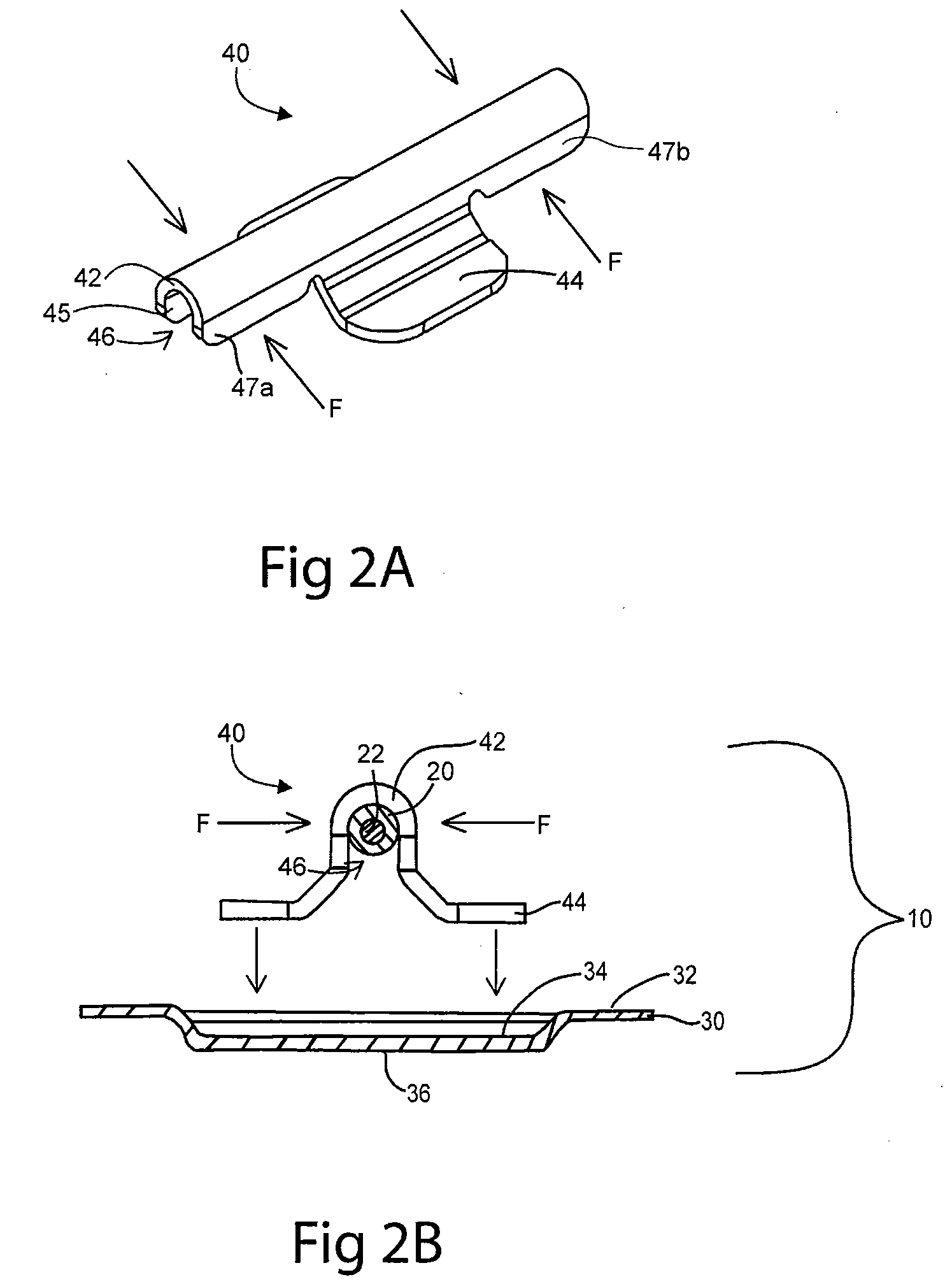 Methods and systems for securing electrode leads