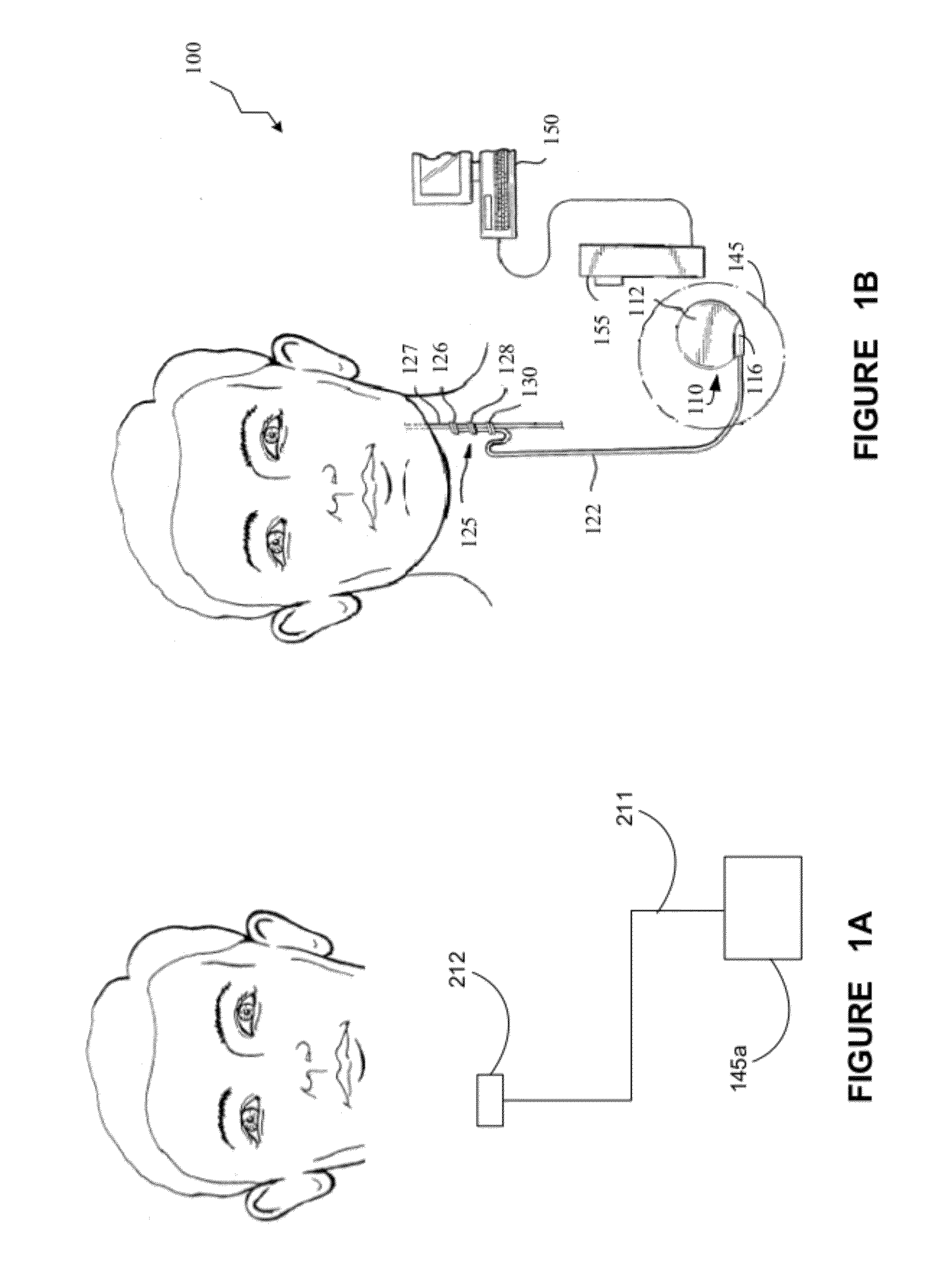 Detecting, quantifying, and/or classifying seizures using multimodal data