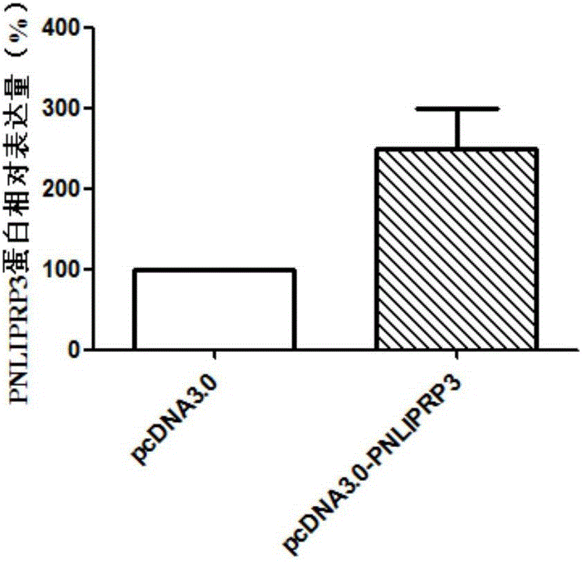 PNLIPRP3 gene and application of expression product of gene in tongue squamous carcinoma diagnosis and treatment