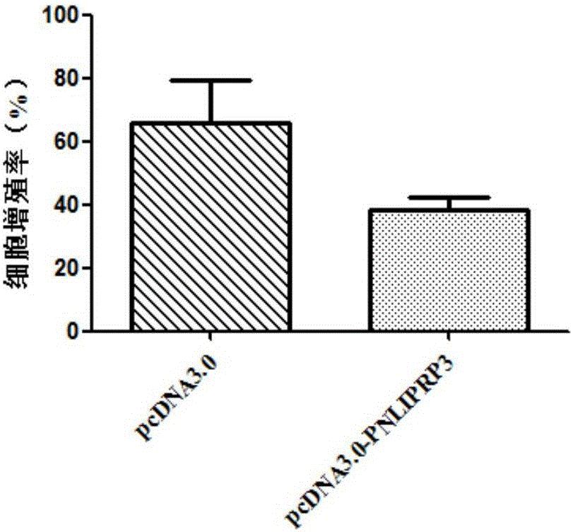 PNLIPRP3 gene and application of expression product of gene in tongue squamous carcinoma diagnosis and treatment