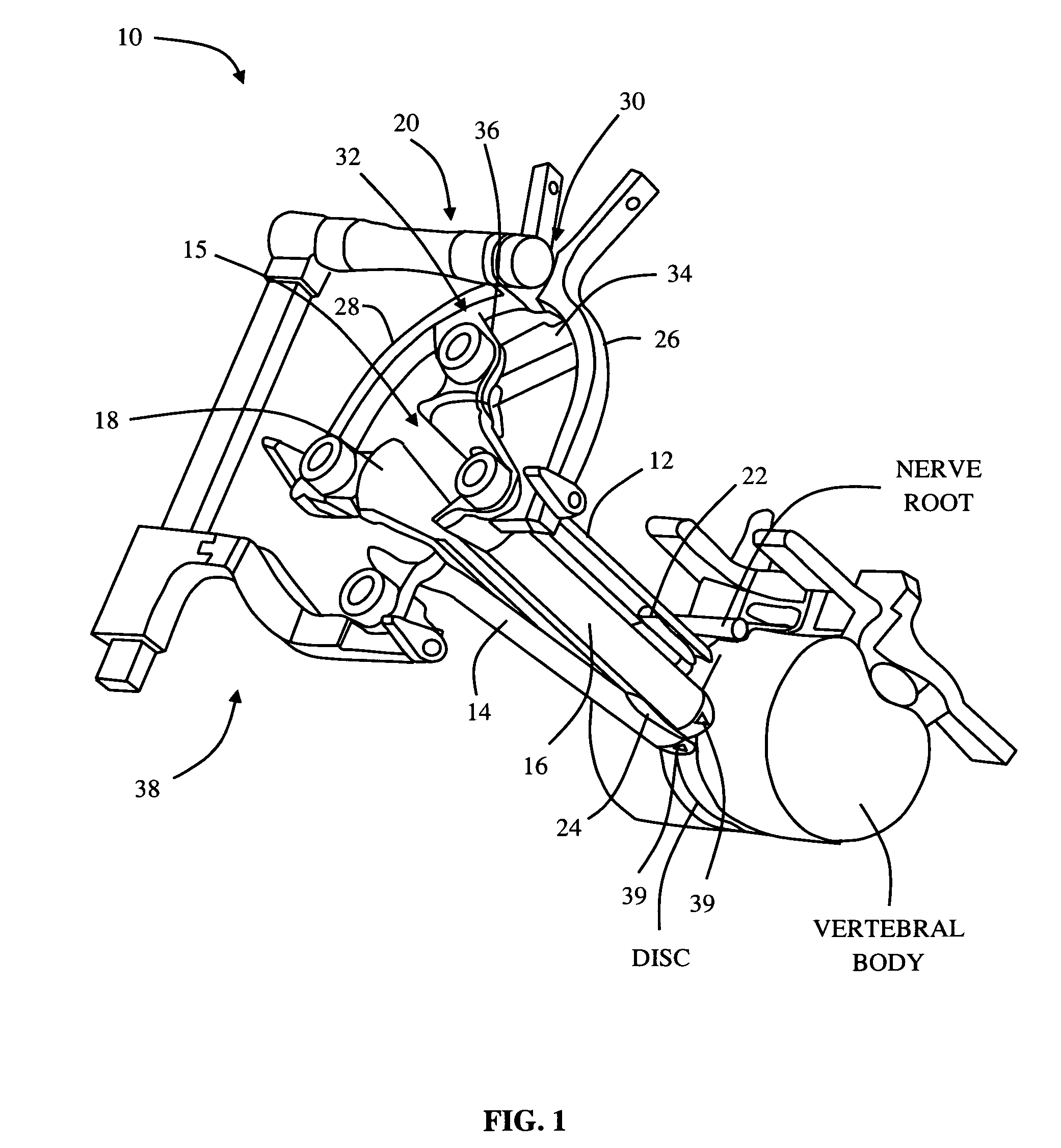 Surgical access system and related methods