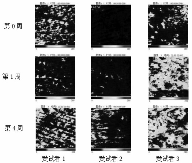 Plant composition as well as preparation method and application thereof