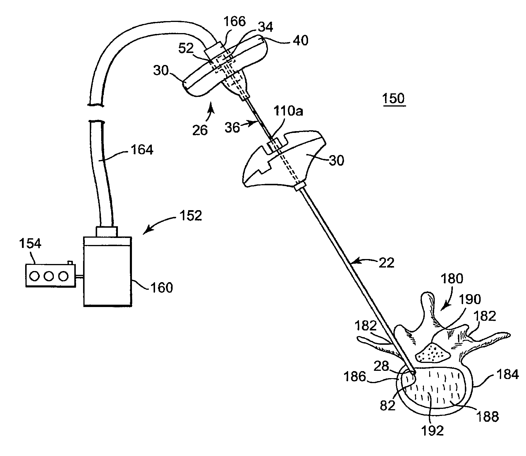 Device, system, and method for forming a cavity in and delivering a curable material into bone