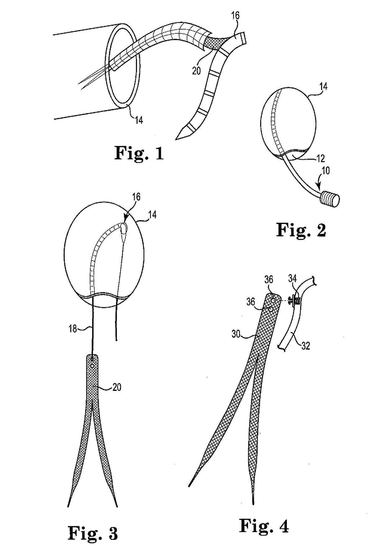 Implants, tools, and methods for treatments of pelvic conditions