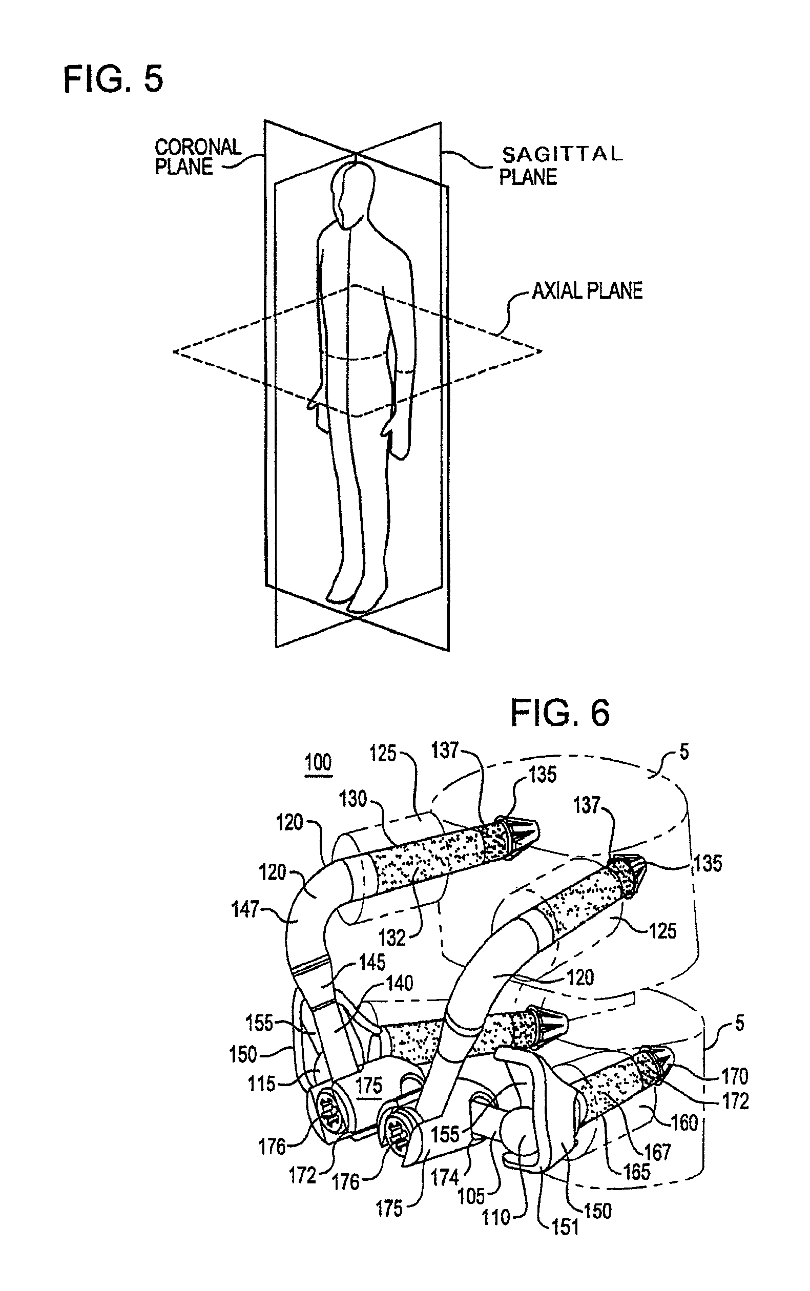 Crossbar spinal prosthesis having a modular design and systems for treating spinal pathologies