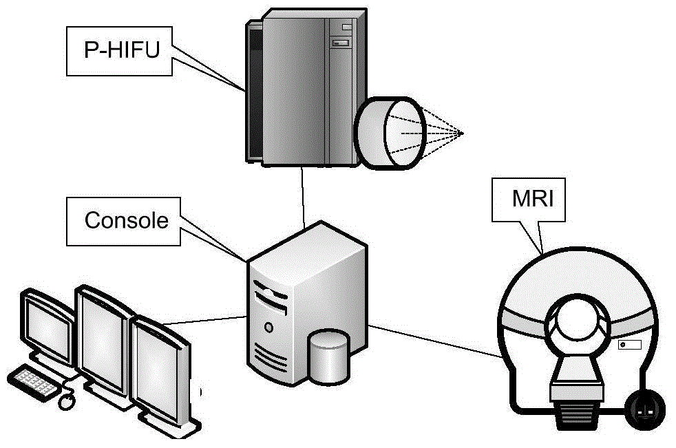 HIFU system based on MR guidance and control method