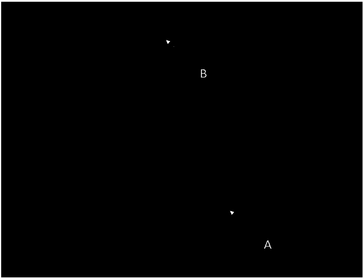 A kit for identifying circulating tumor cells using cd45 immunofluorescence combined with cep probe and its application