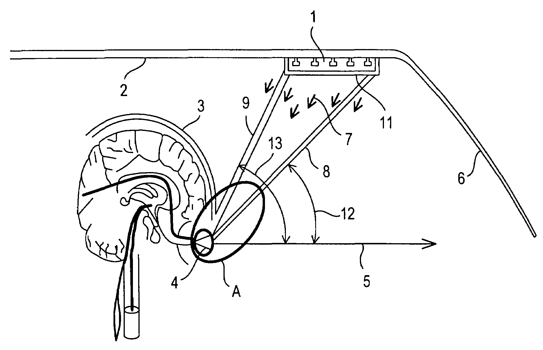 Phototherapy device