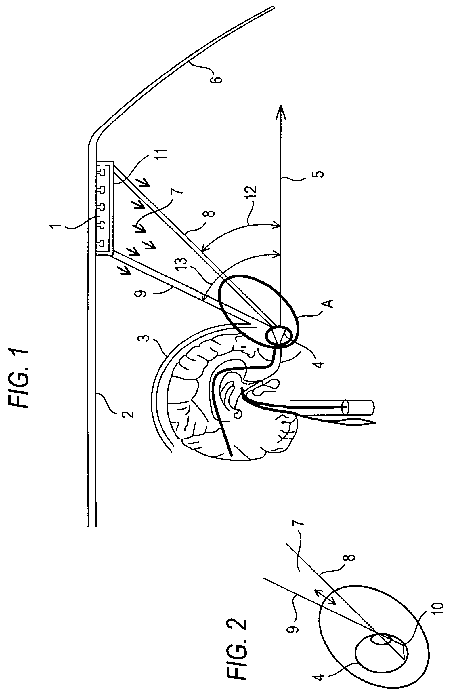 Phototherapy device