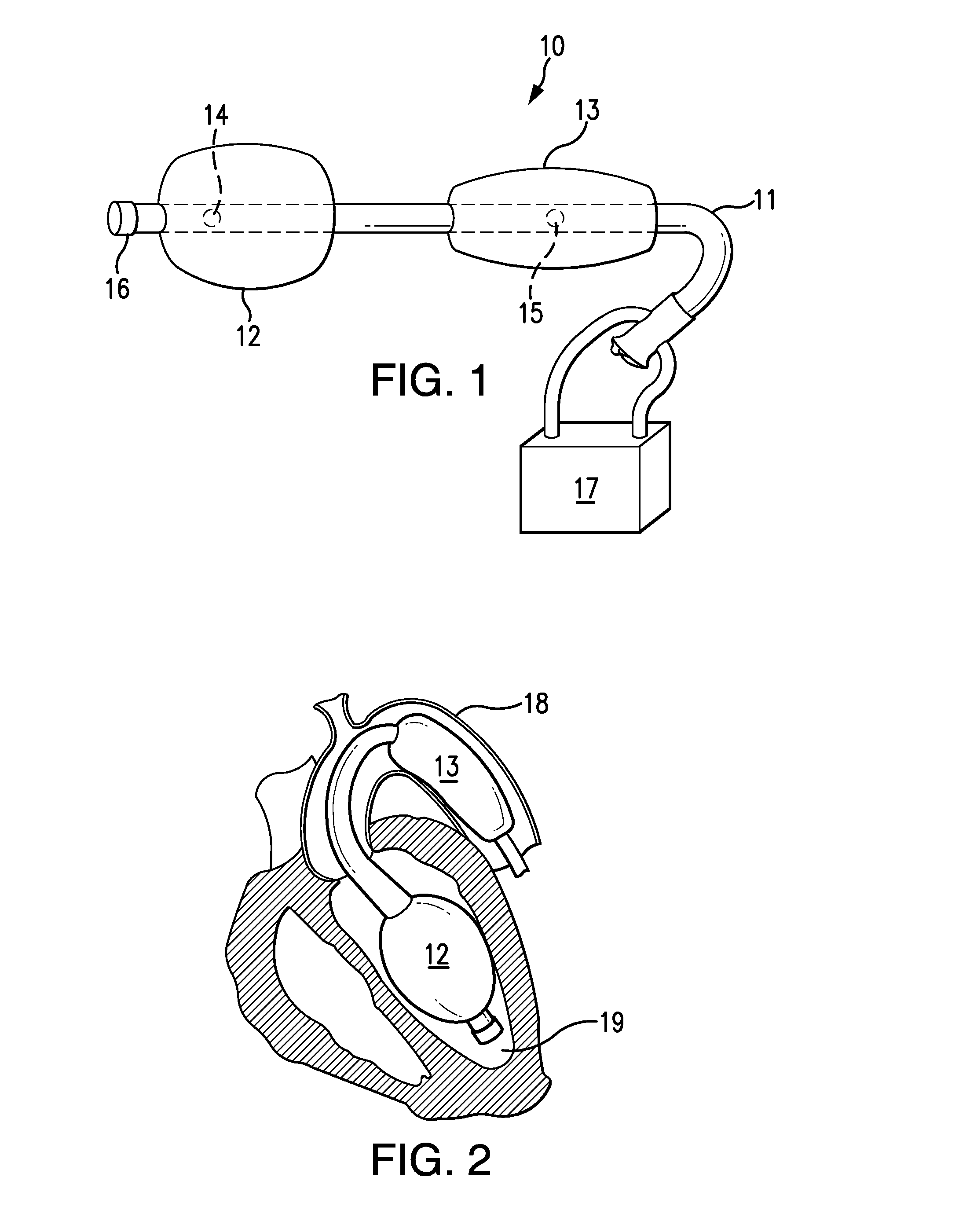 Dual-Balloon Cardiac Pump