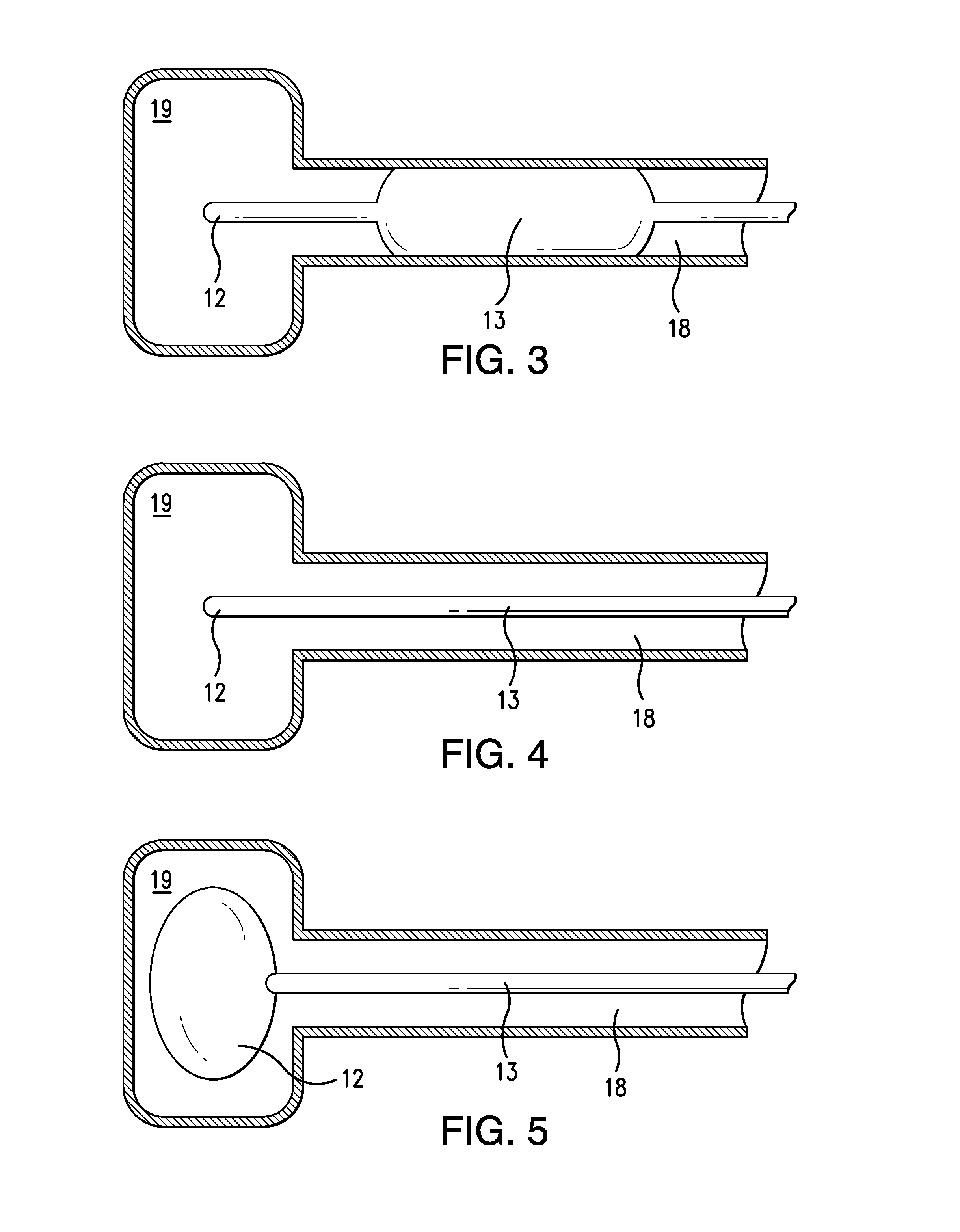 Dual-Balloon Cardiac Pump