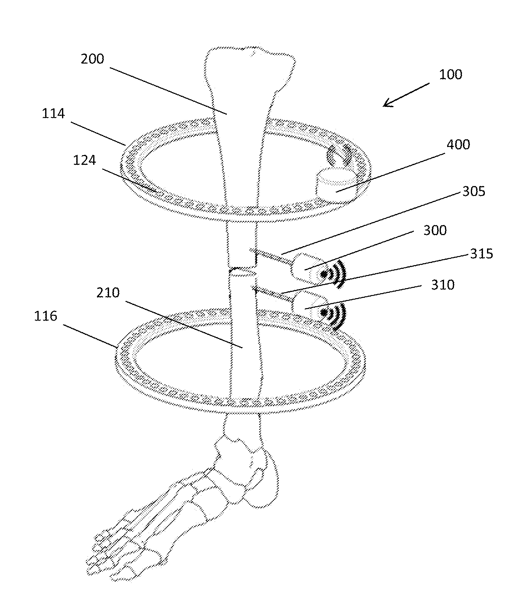 Bone position tracking system