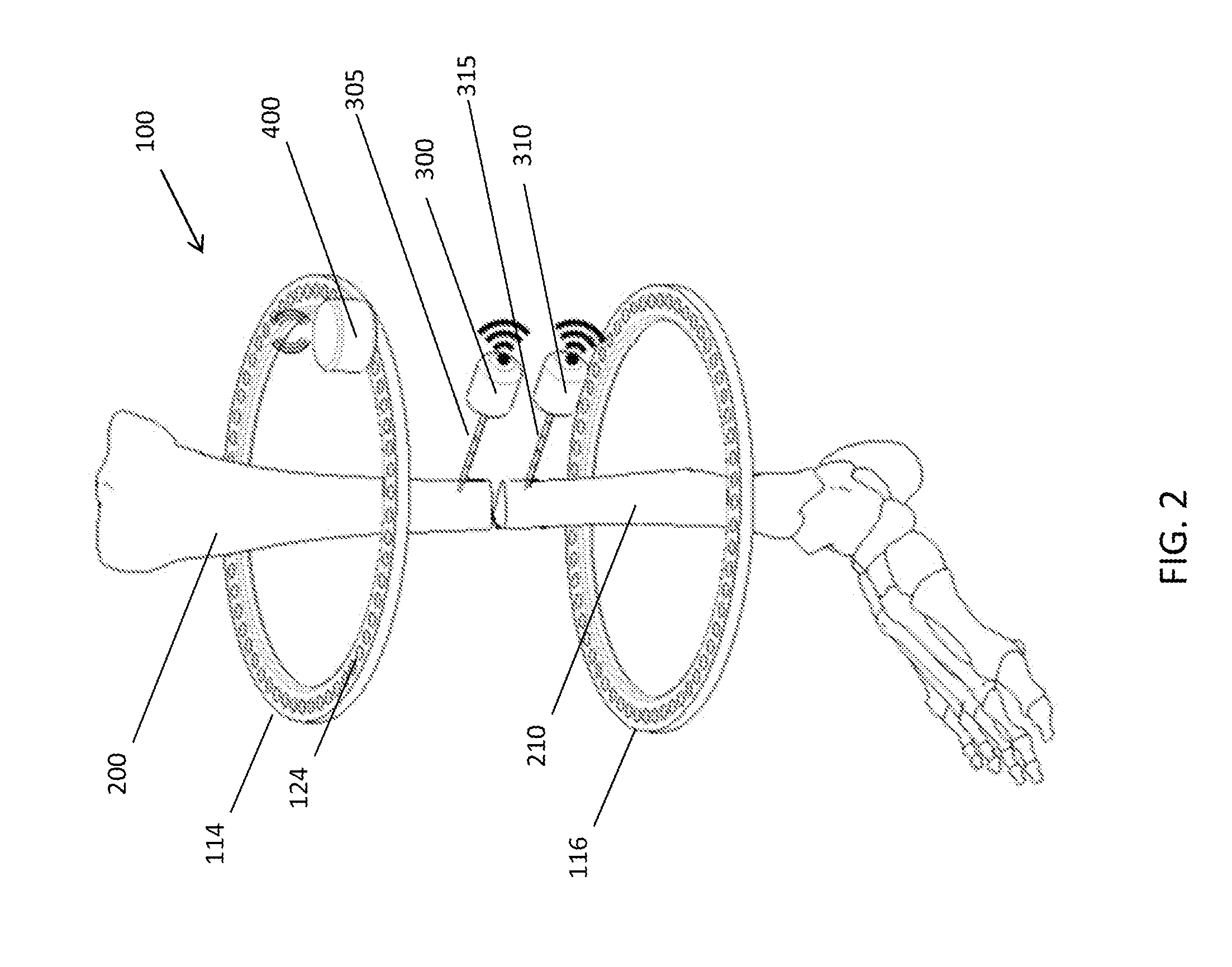 Bone position tracking system