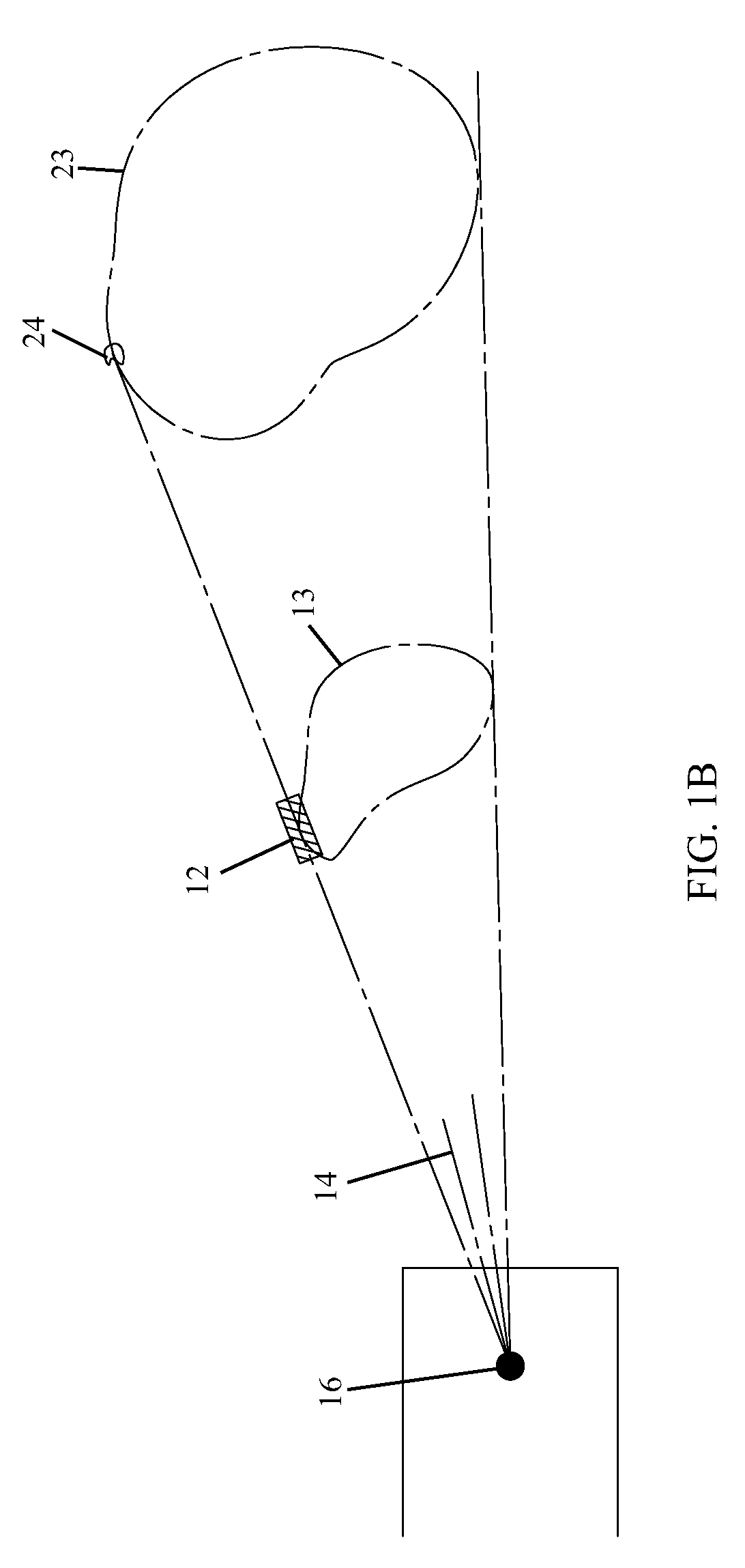 Stereotactic radiotherapy with rotating attenuator