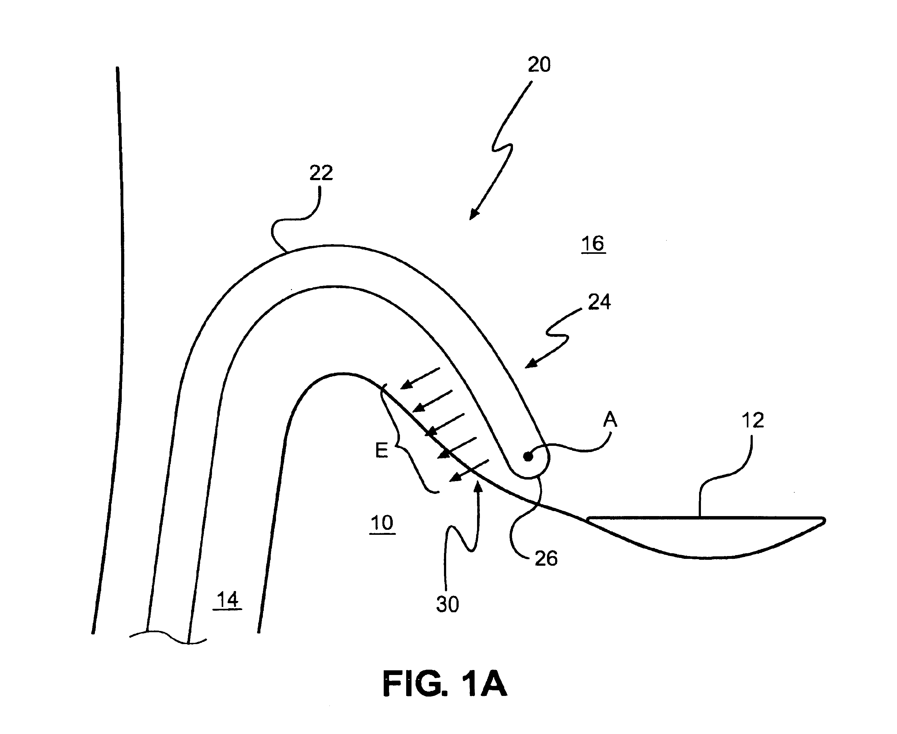 Catheter having improved steering