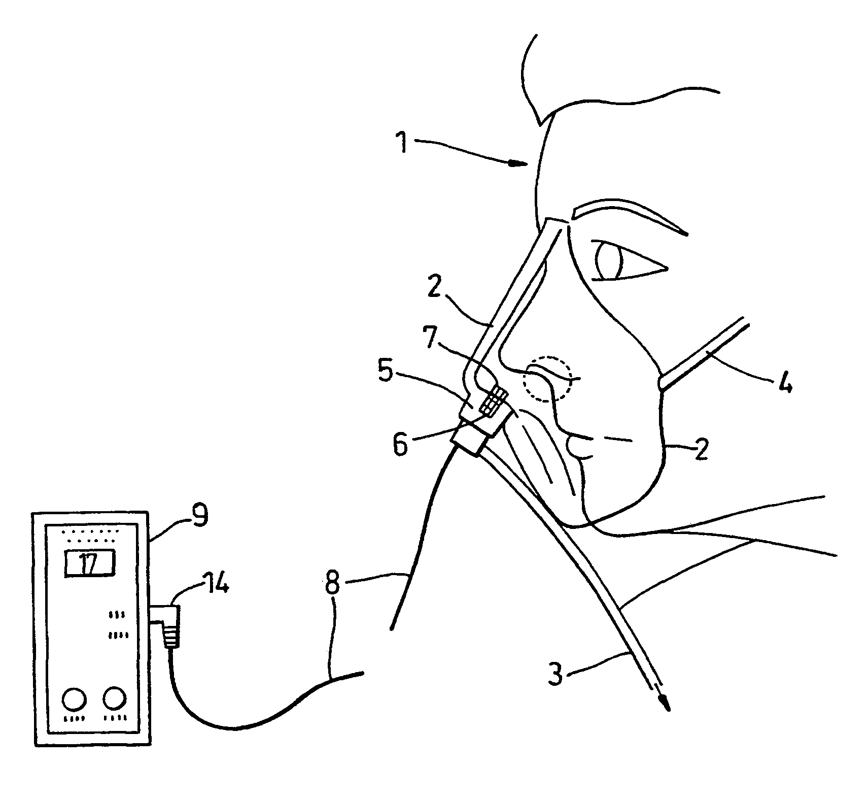 Respiration monitoring equipment