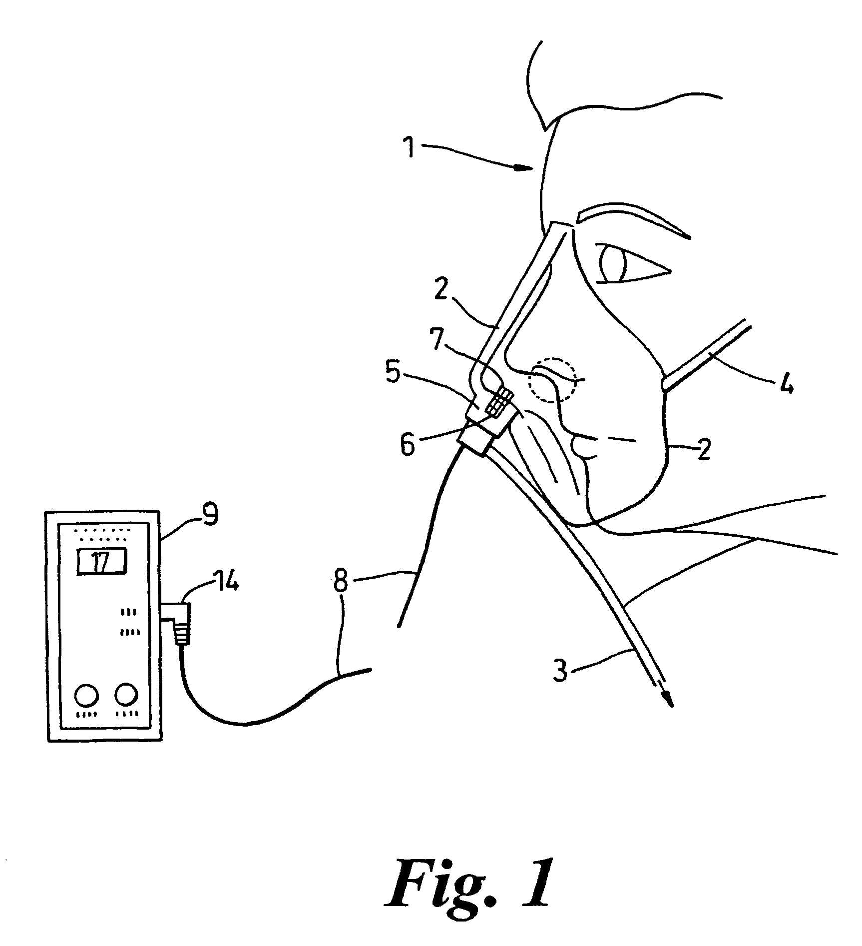 Respiration monitoring equipment